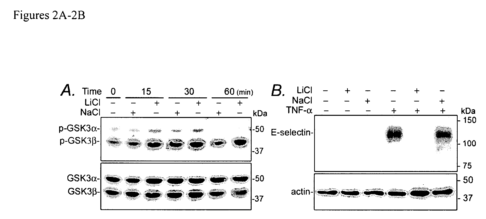 Compositions and methods for detecting and treating renal injury and inflammation