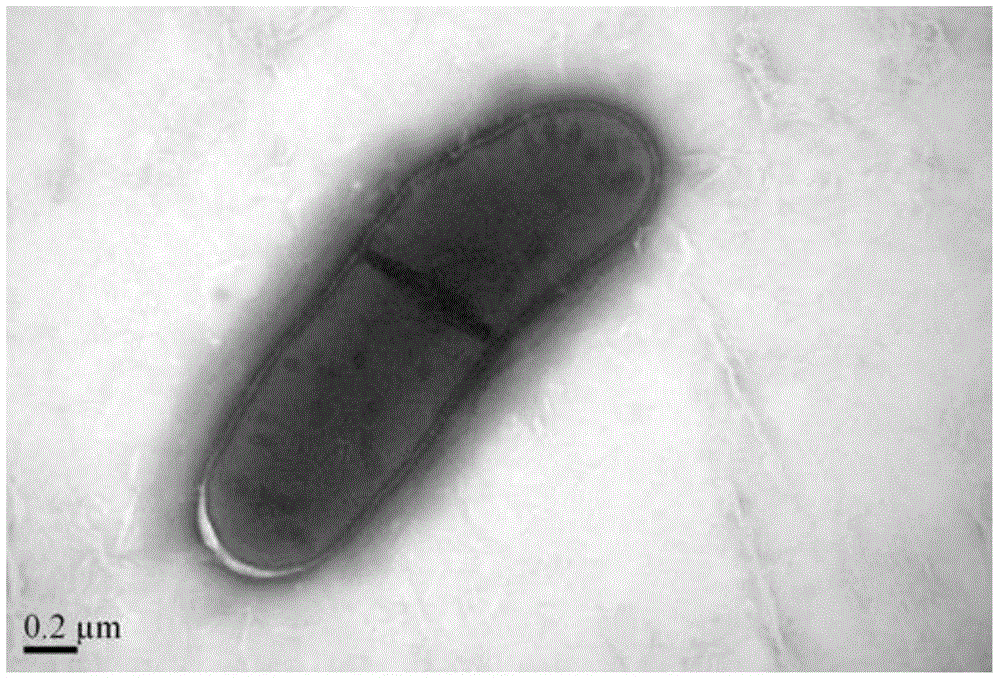 Rhodococcus strain capable of degrading metamitron and application of rhodococcus strain