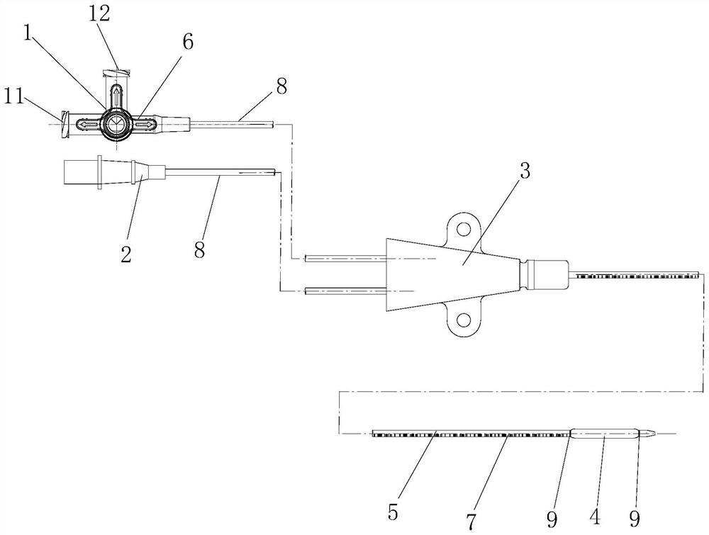 Ureteral catheter and use method