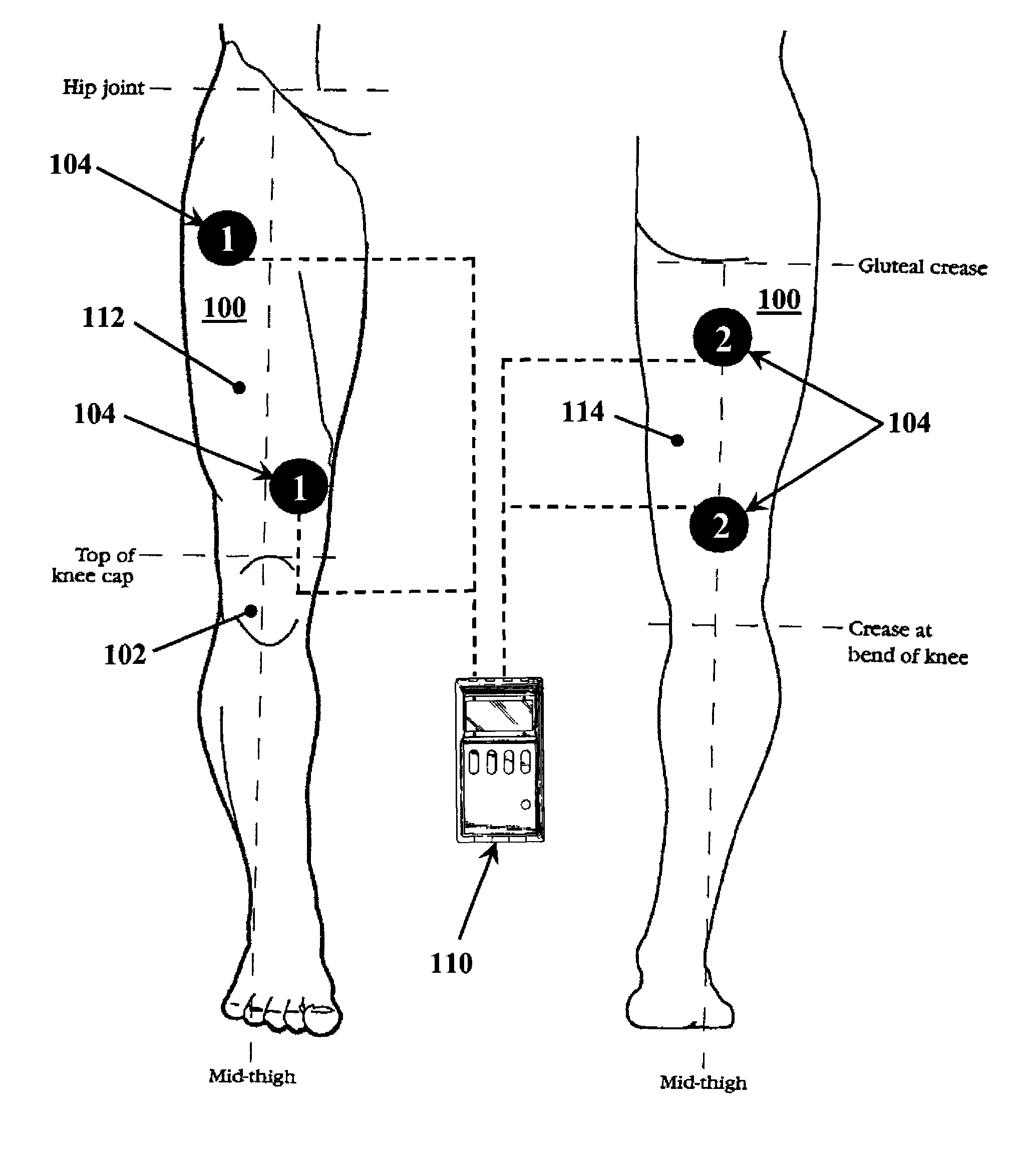 Methods for improving mobility and controlling cartilage matrix degradation of weight-bearing articular joints