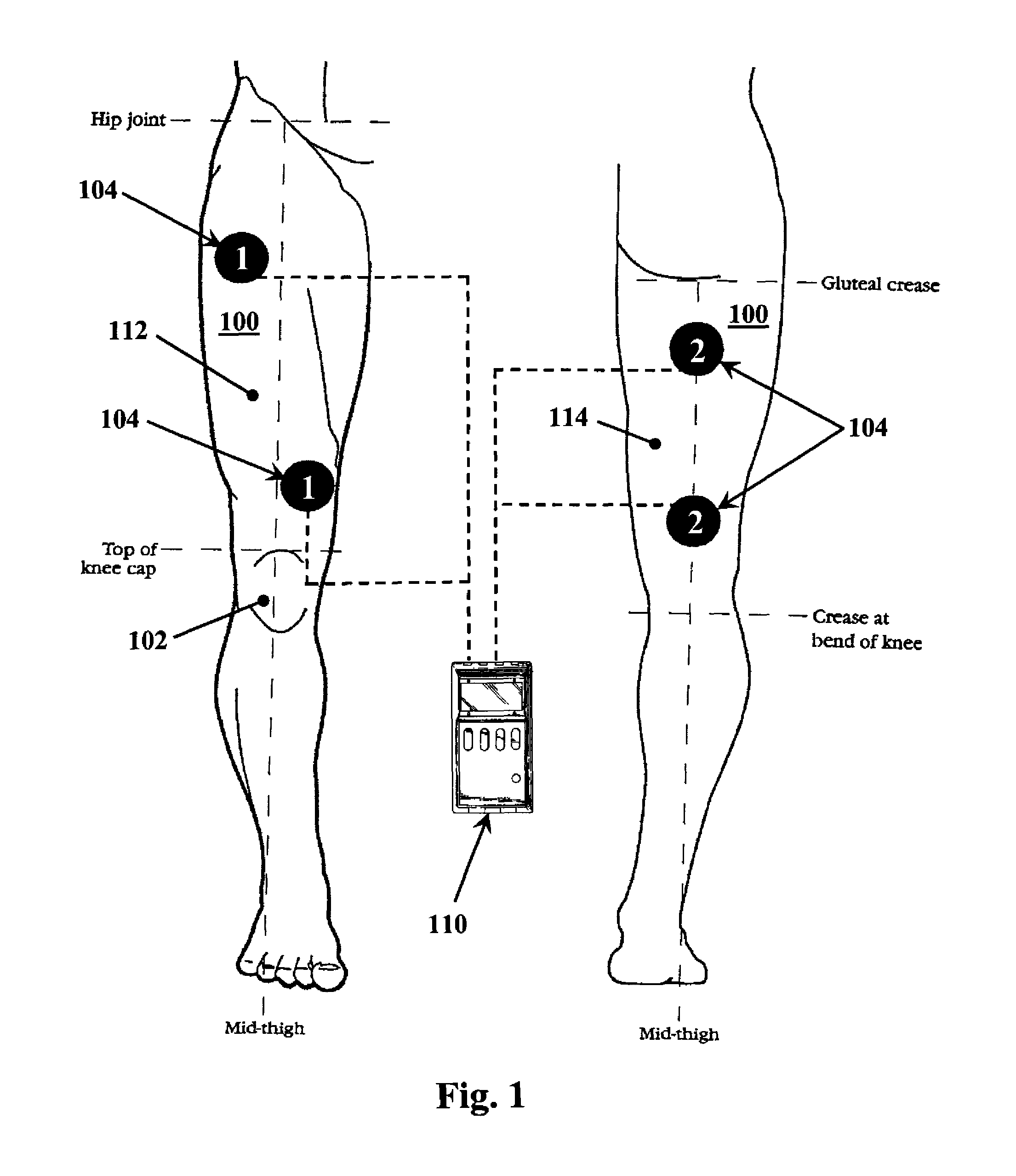 Methods for improving mobility and controlling cartilage matrix degradation of weight-bearing articular joints