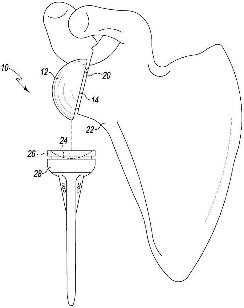 Inverted shoulder orthopaedic implant with oval glenoid convex bearing head component