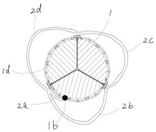 Asymmetric artificial aortic valve using eccentric limiting keys for intervention