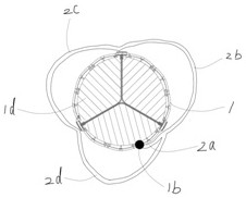 Asymmetric artificial aortic valve using eccentric limiting keys for intervention