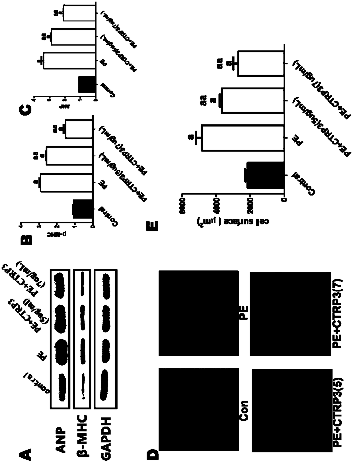 Application of CTRP3 to preparation of drugs for preventing and treating cardiac hypertrophy