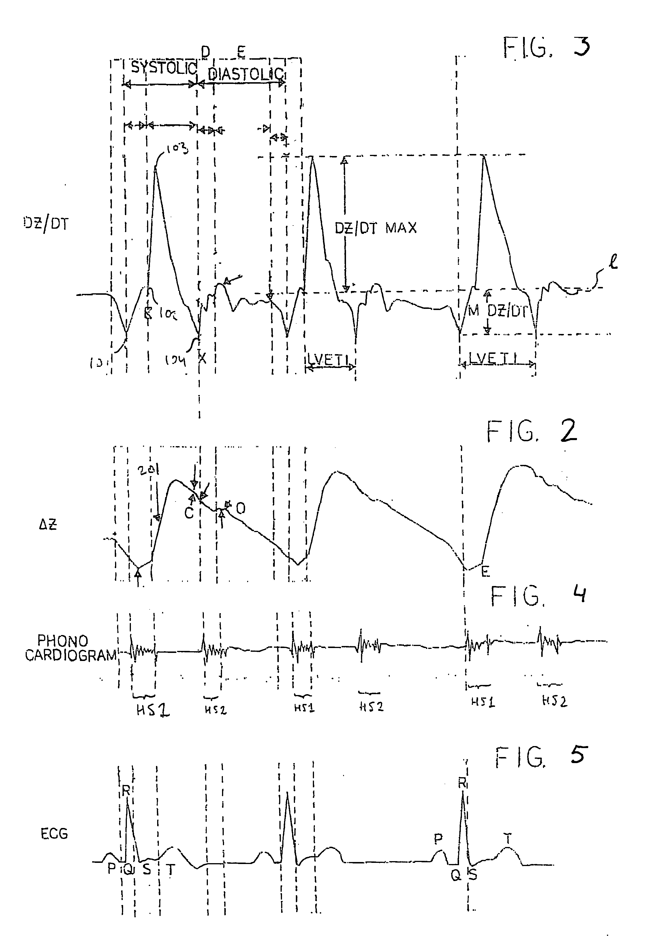 Device and method for measuring cardiac function
