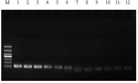 Fluorescence quantitative RT-PCR (reverse transcription-polymerase chain reaction) kit for rapidly detecting XHF (Xinjiang hemorrhagic fever) viruses