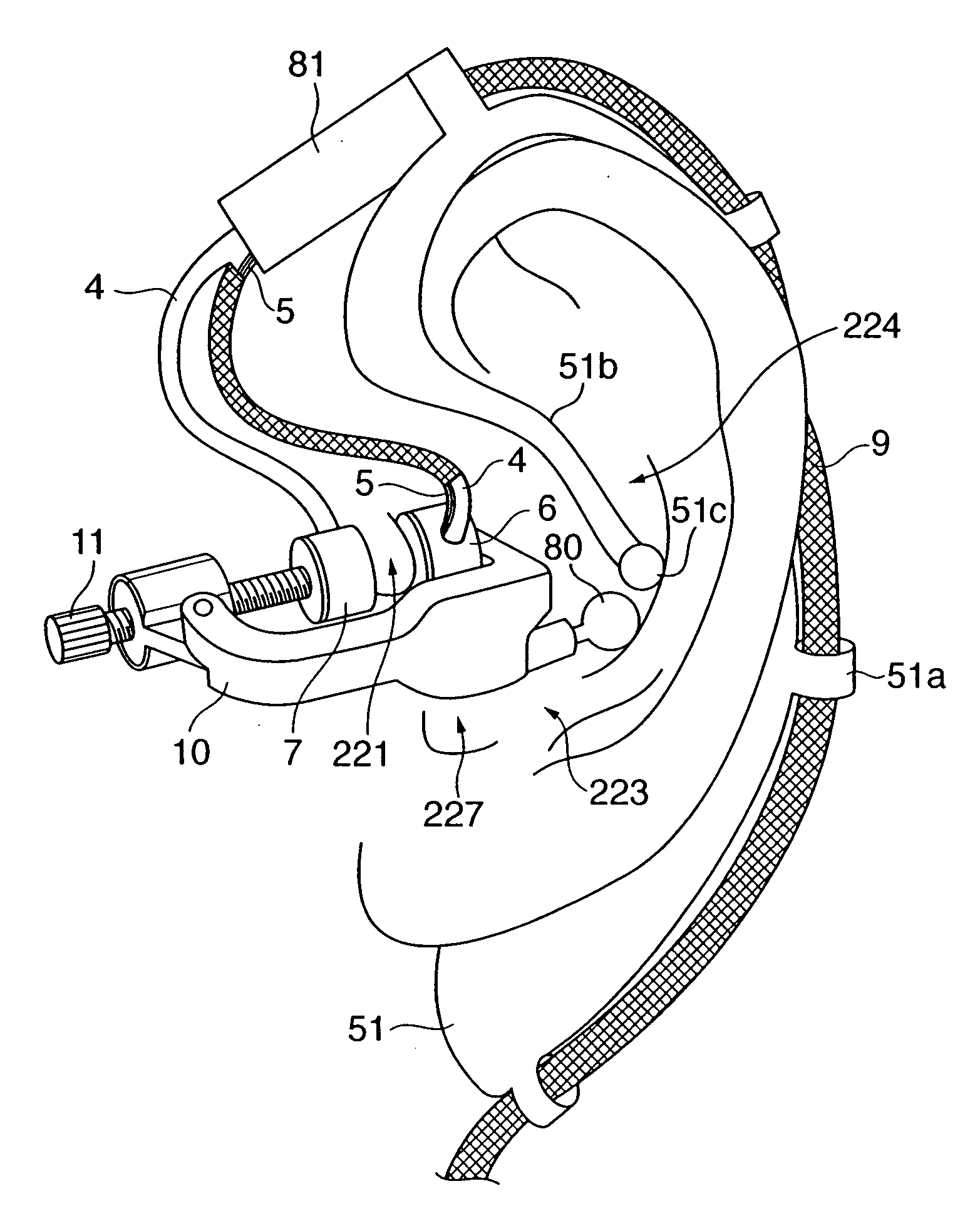 Blood pressure measuring apparatus