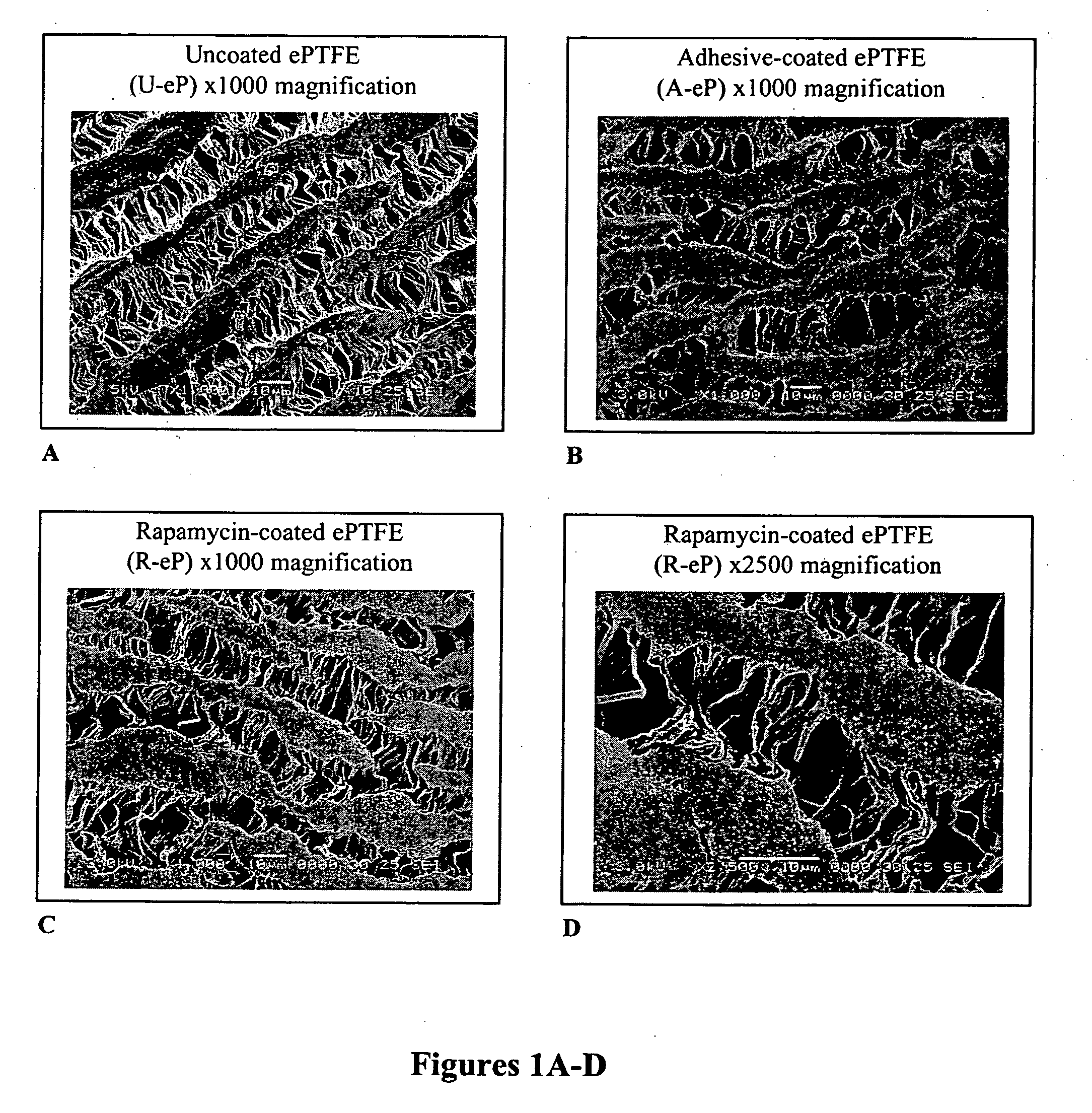 Adhesive composition for carrying therapeutic agents as delivery vehicle on coatings applied to vascular grafts