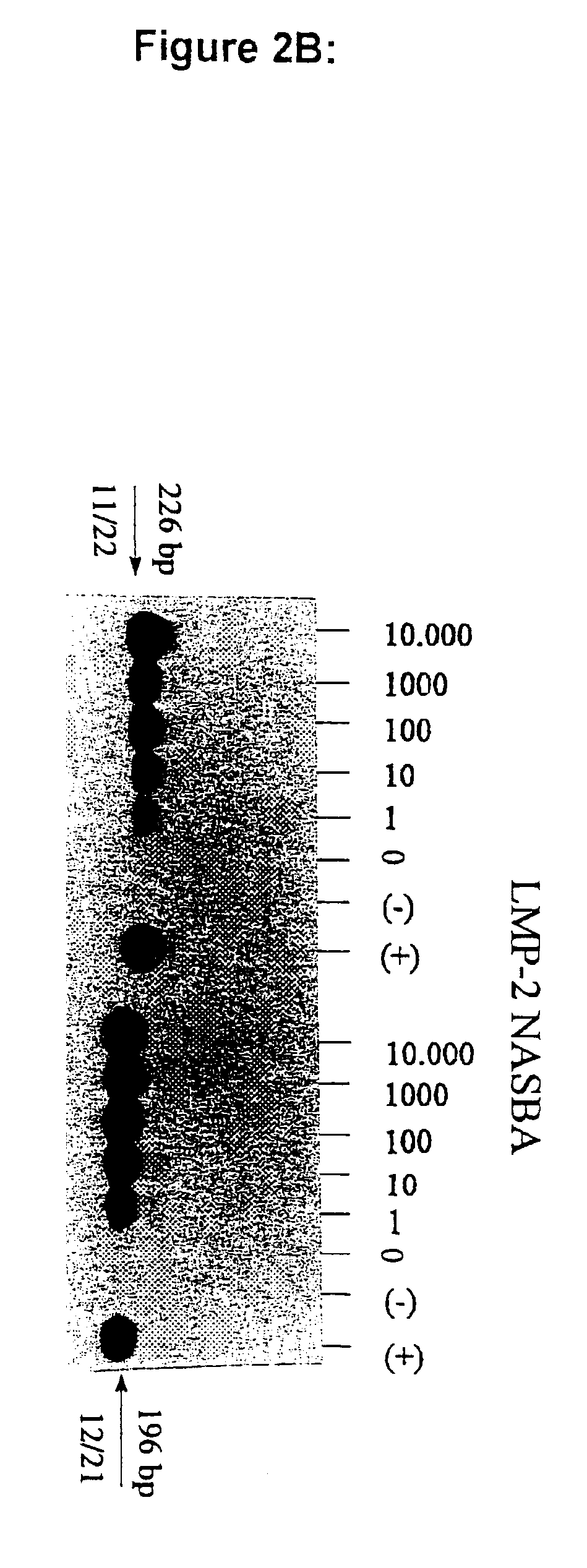 Oligonucleotides for the amplification and detection of Epstein Barr Virus (EBV) nucleic acid