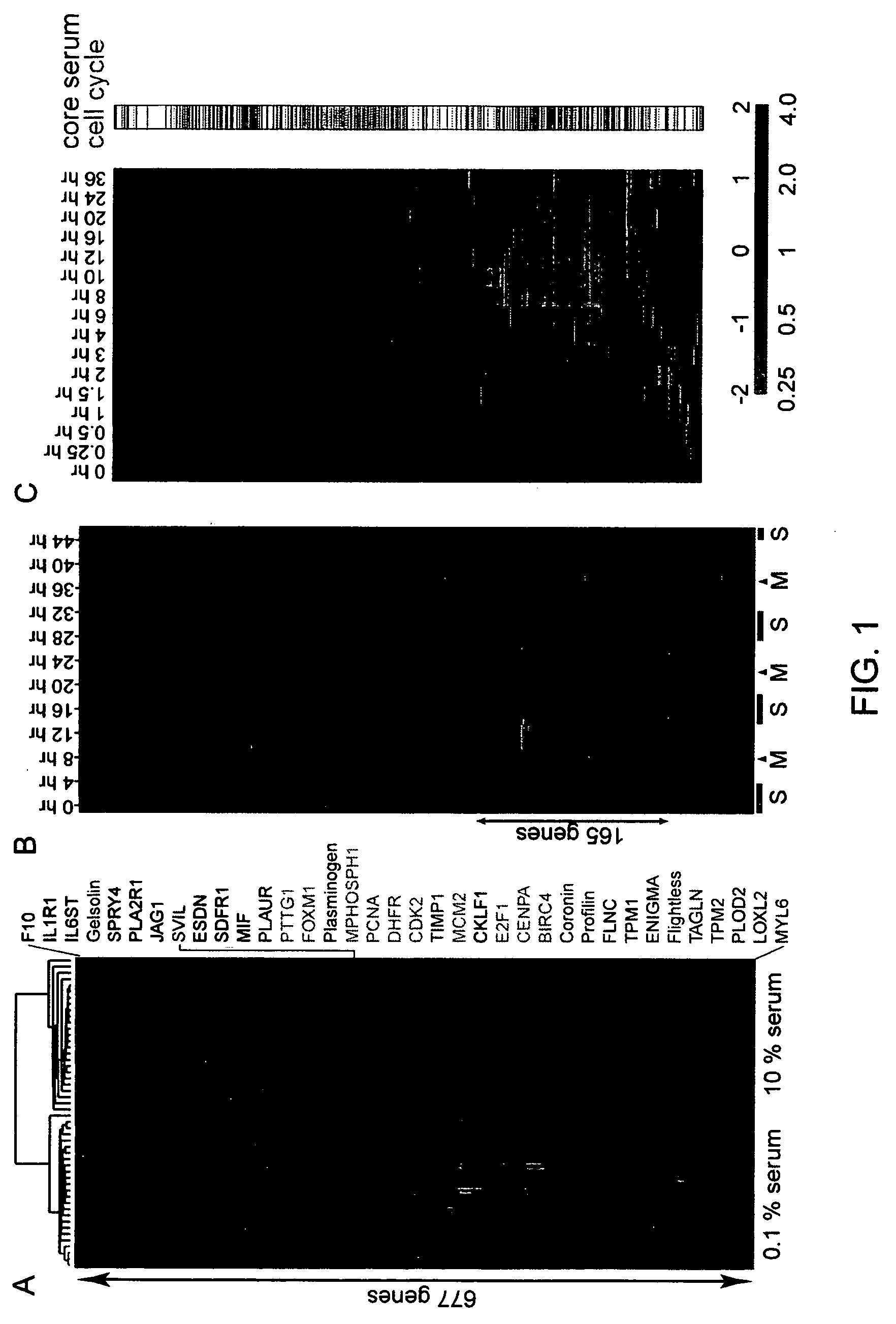 Gene expression signature for prediction of human cancer progression