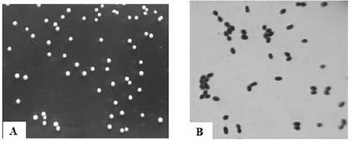 A Strain of Lactococcus lactis CAMT22361 Degrading t-2 Toxin