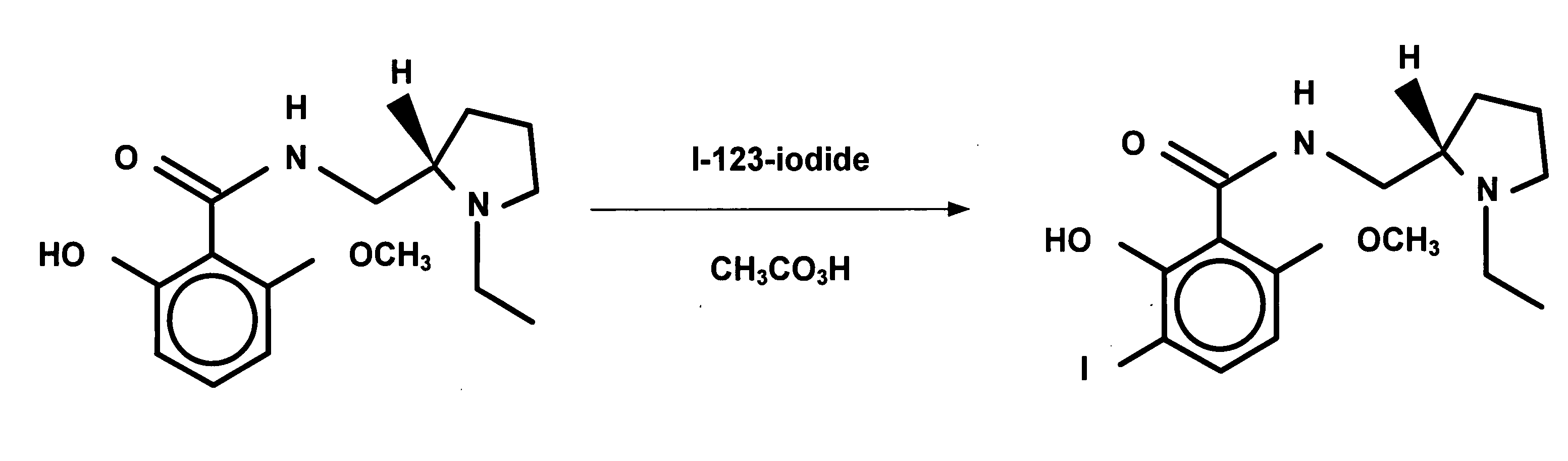 Method of obtaining BZM purity, quantity of [123I]IBZM labeled ligand and quantity of BZM free ligand