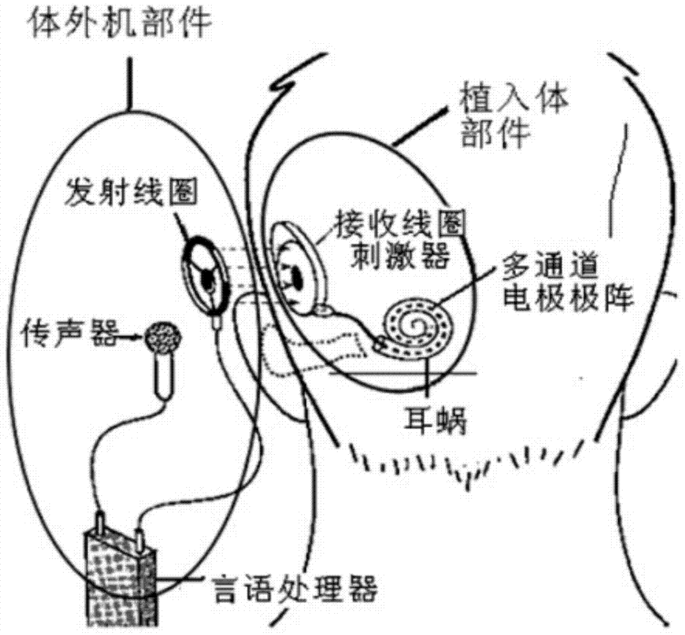 Electrical cochlea reverse signal radio frequency transmission receiving chip and system