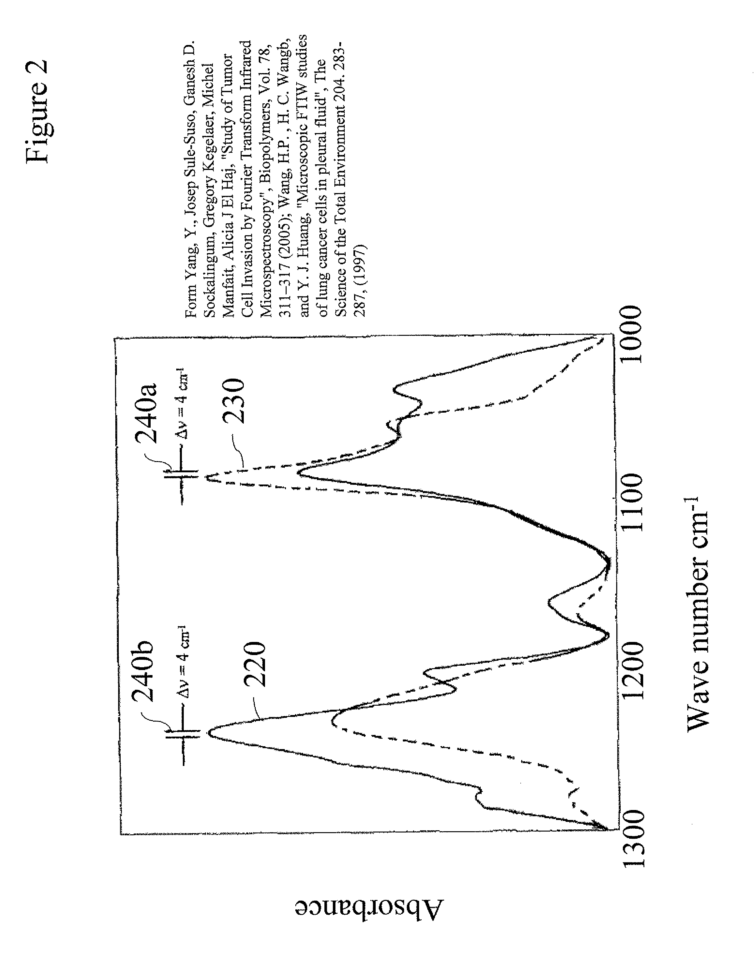 Method Of Infrared Thermography For Earlier Diagnosis Of Gastric Colorectal And Cervical Cancer