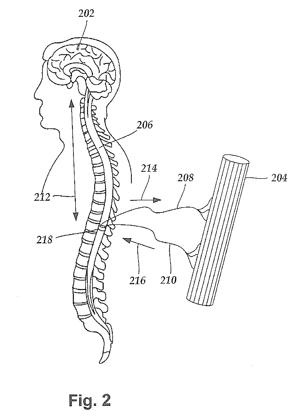 Systems and methods for treating essential tremor or restless leg syndrome using spinal cord stimulation