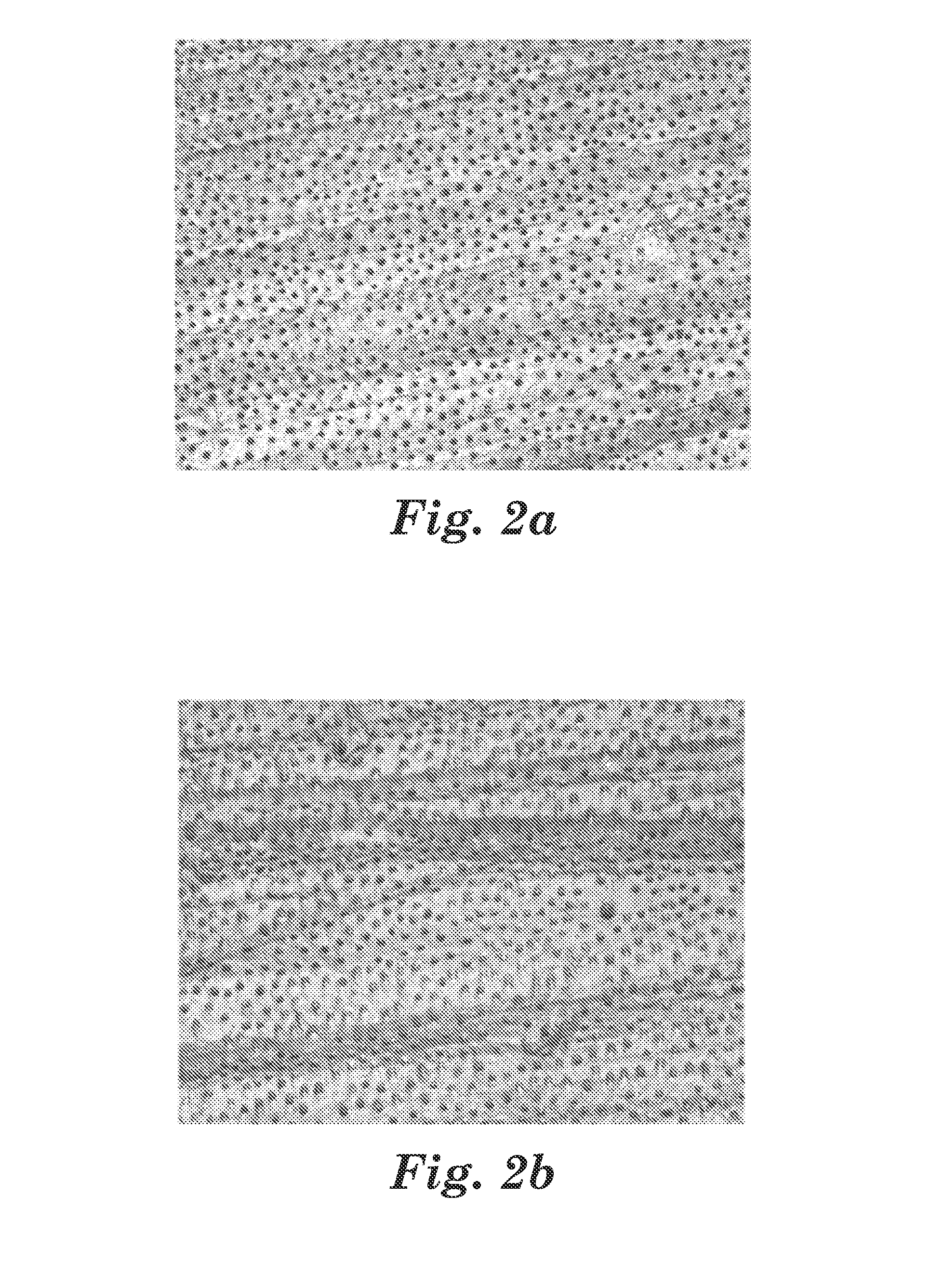 Powder composition for air polishing the surface of hard dental tissue