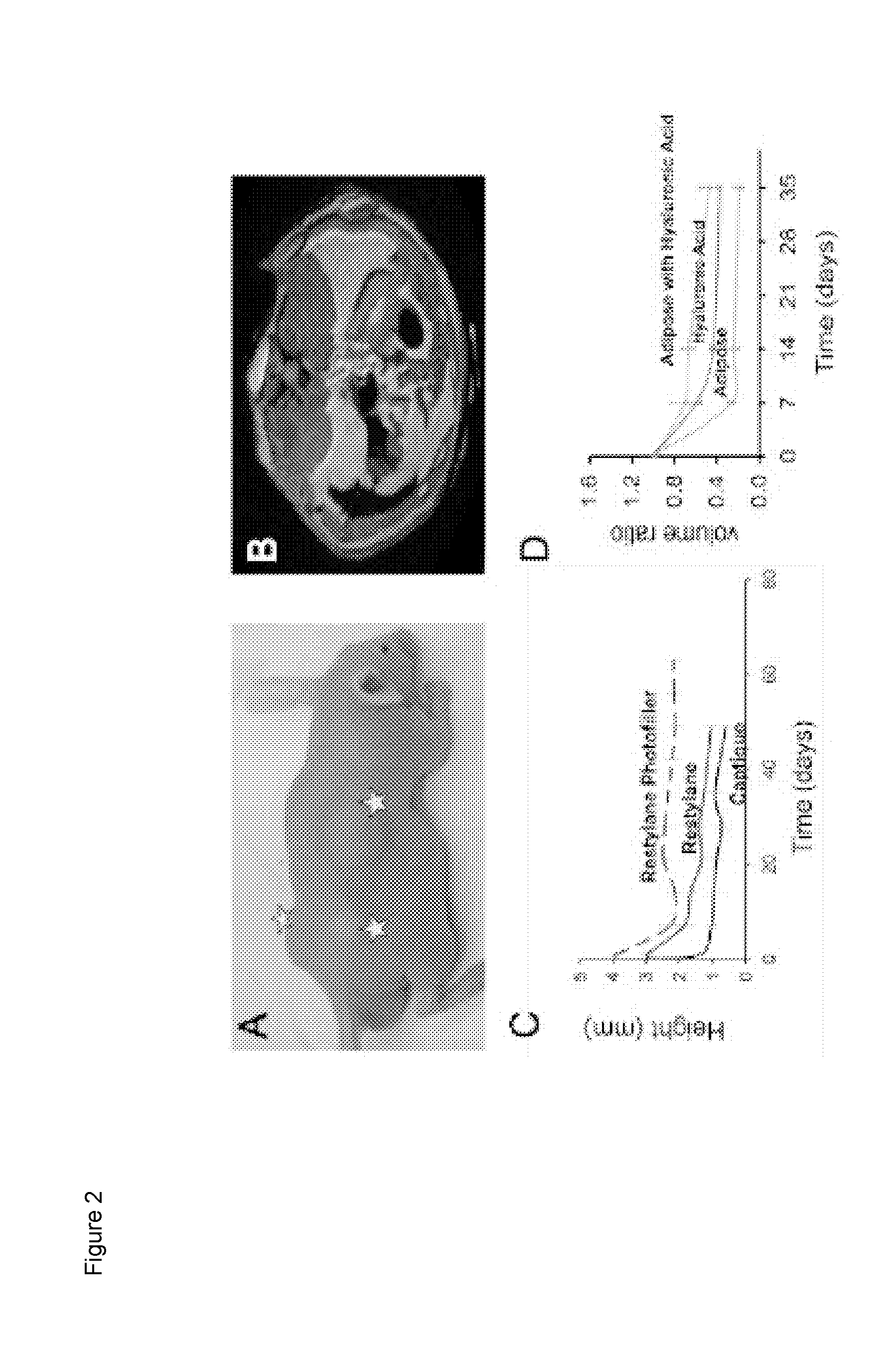 Compositions and Methods for Implantation of Processed Adipose Tissue and Processed Adipose Tissue Products