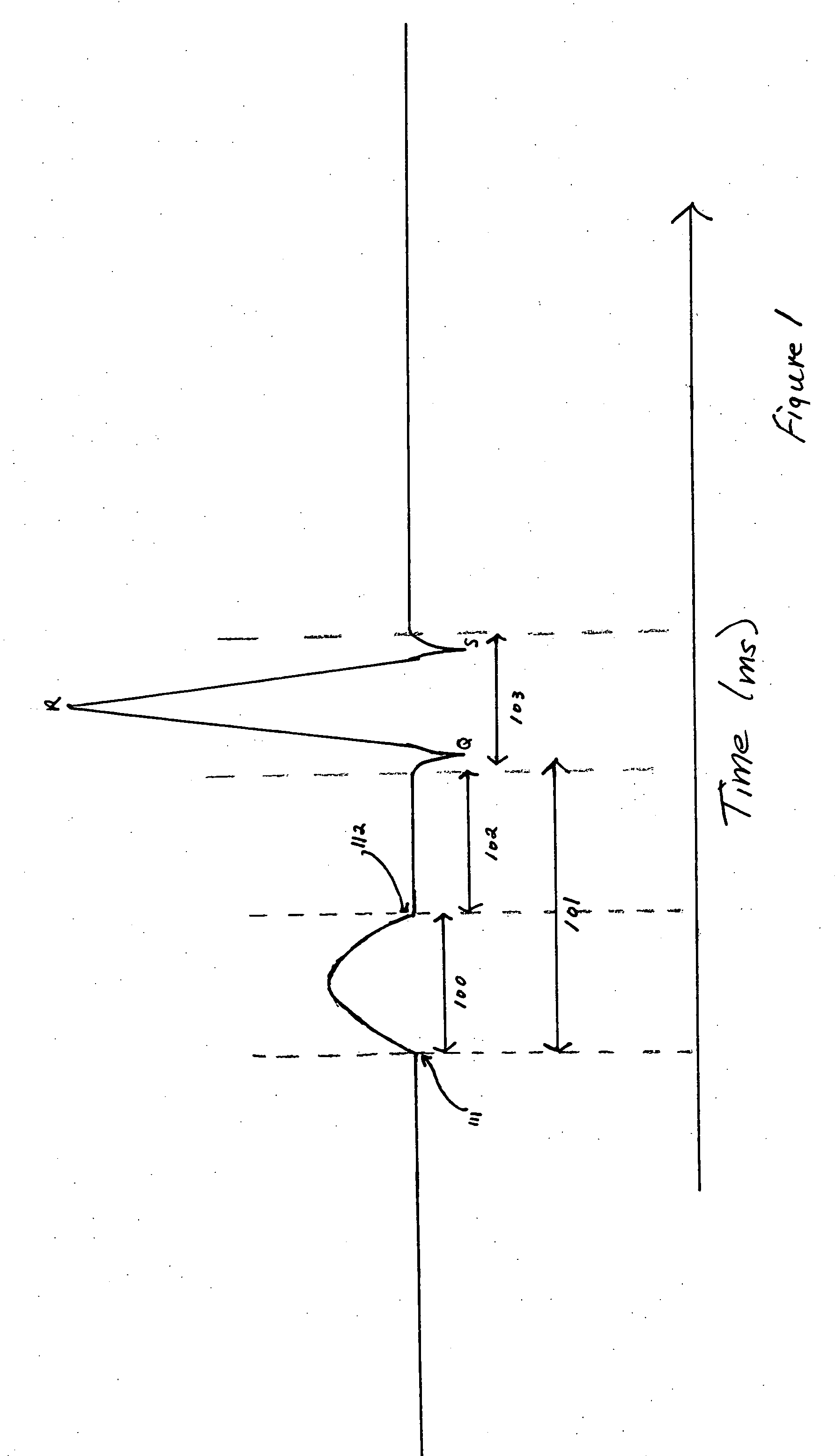 Cardiac pacemaker with dynamic conduction time monitoring