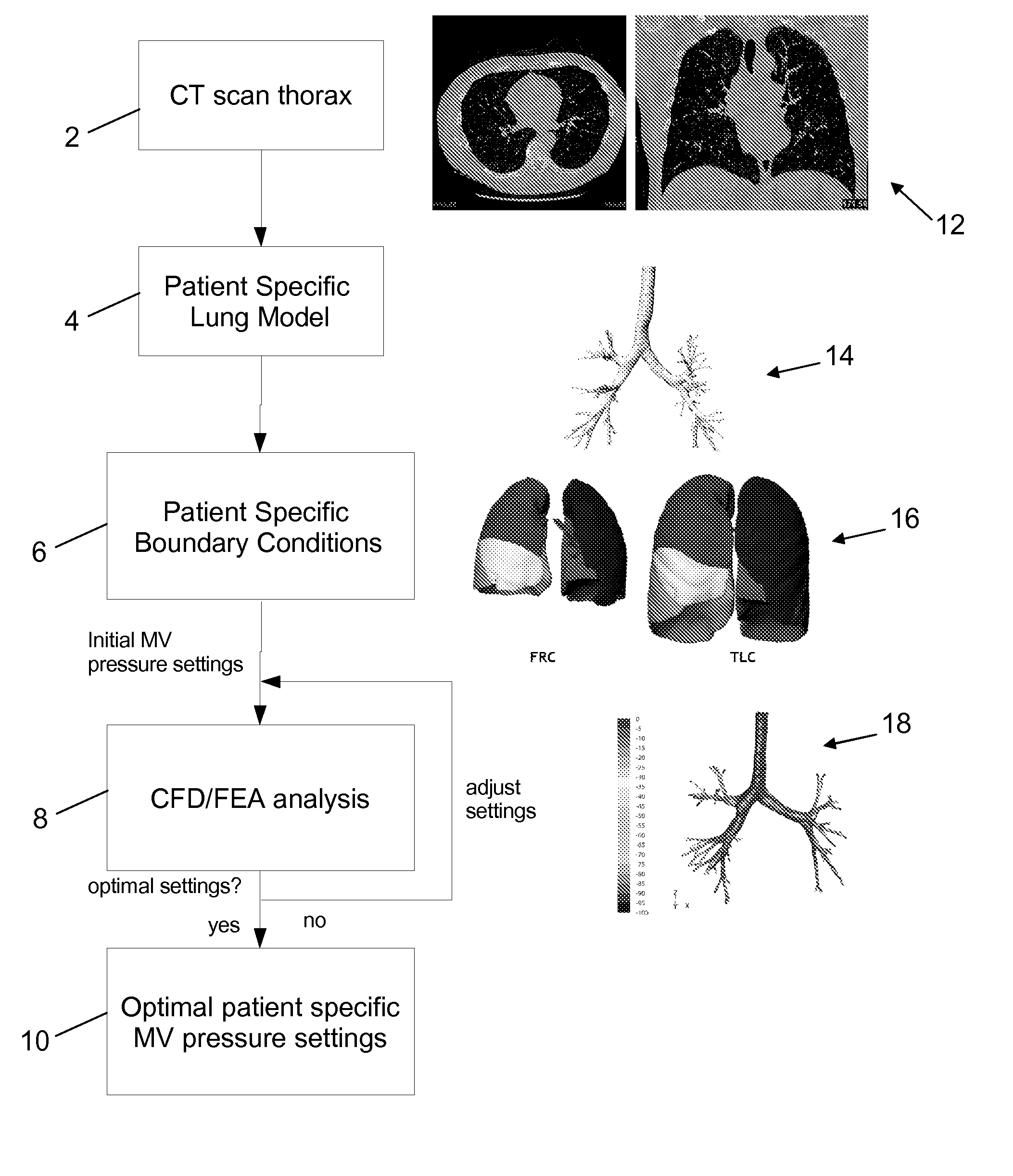 Method for determining treatments using patient-specific lung models and computer methods