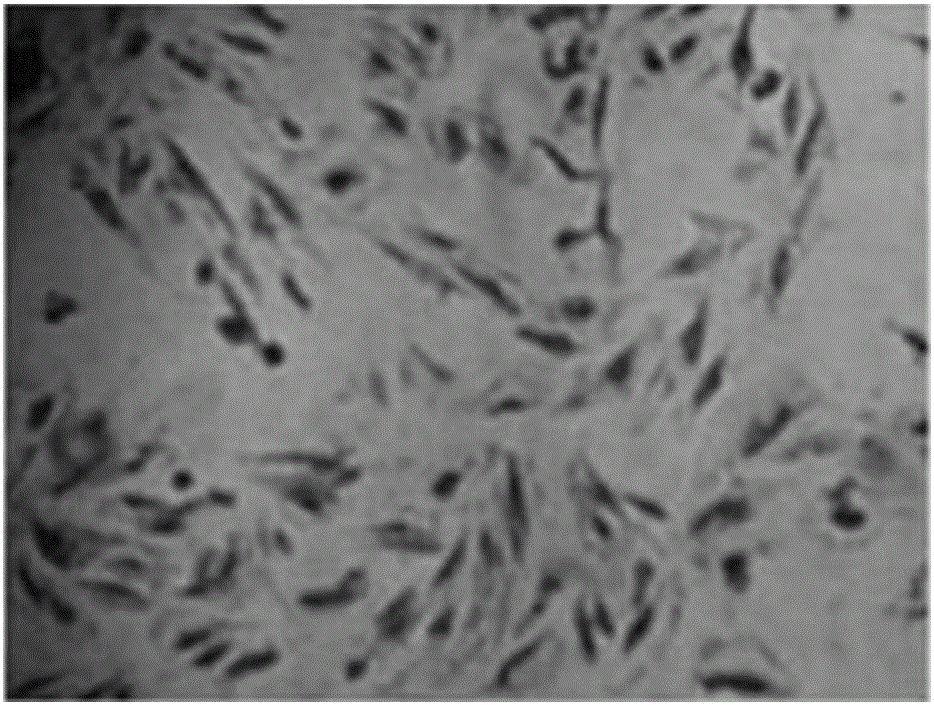 Application of Maqian essential oil in preparation of drug for preventing and treating adenomyosis