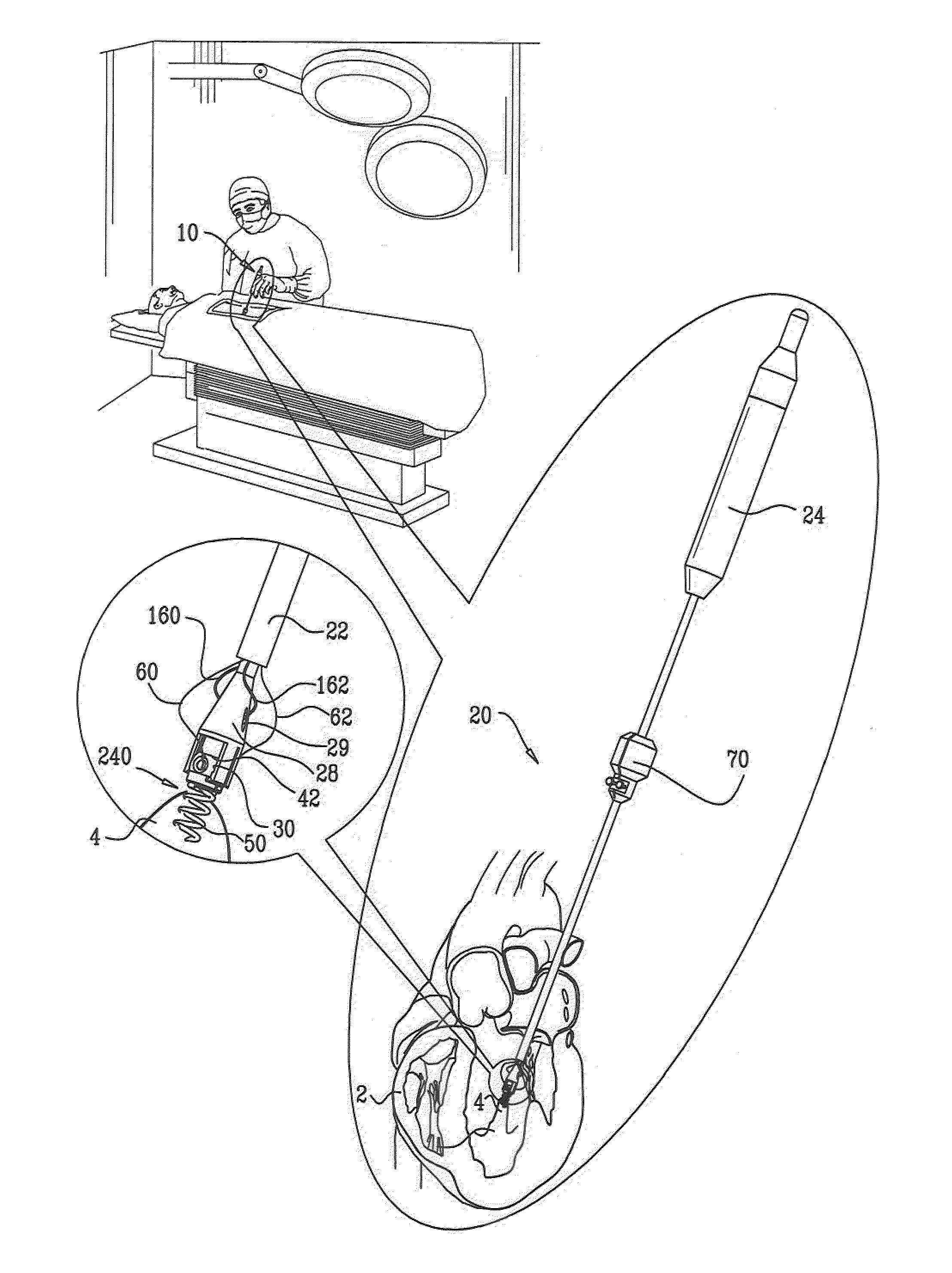 Adjustable repair chords and spool mechanism therefor