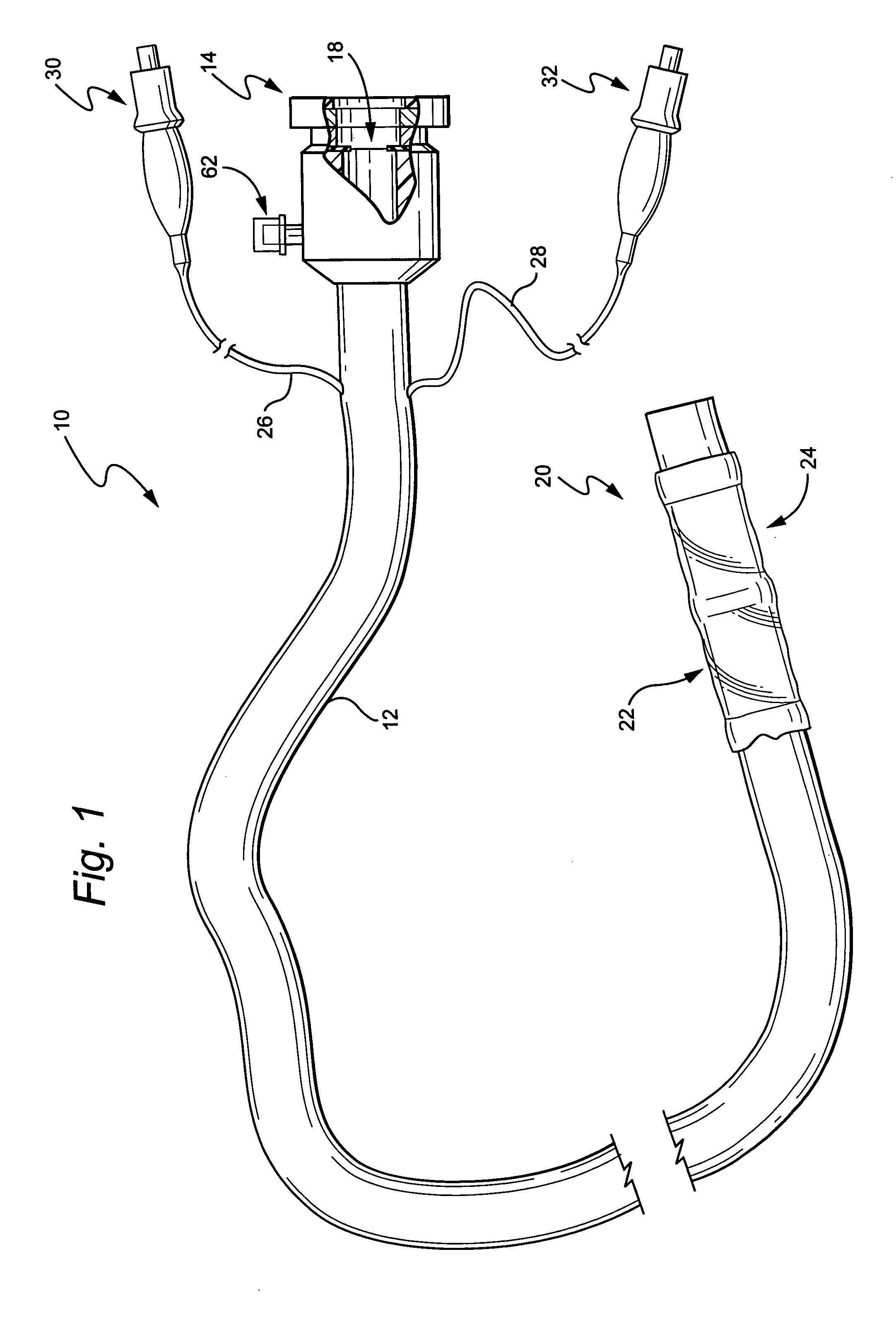 Methods and devices for diagnostic and therapeutic interventions in the peritoneal cavity