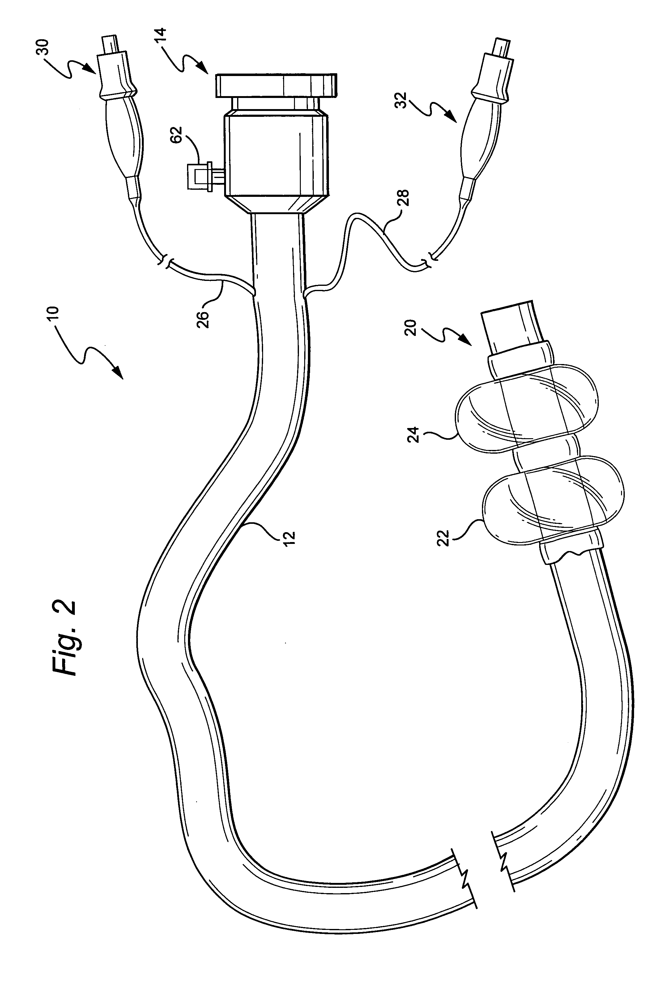 Methods and devices for diagnostic and therapeutic interventions in the peritoneal cavity