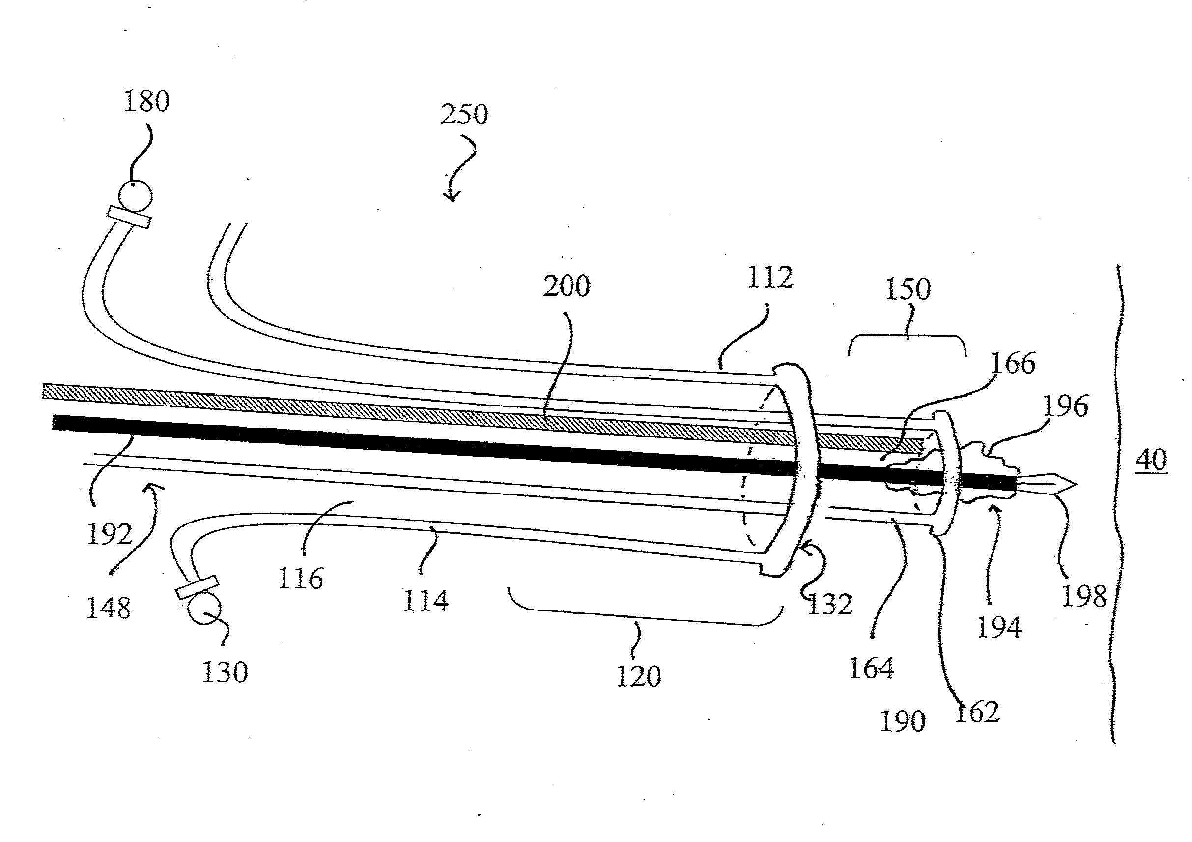 Devices, systems, and methods for diagnosing and delivering therapeutic interventions in the peritoneal cavity