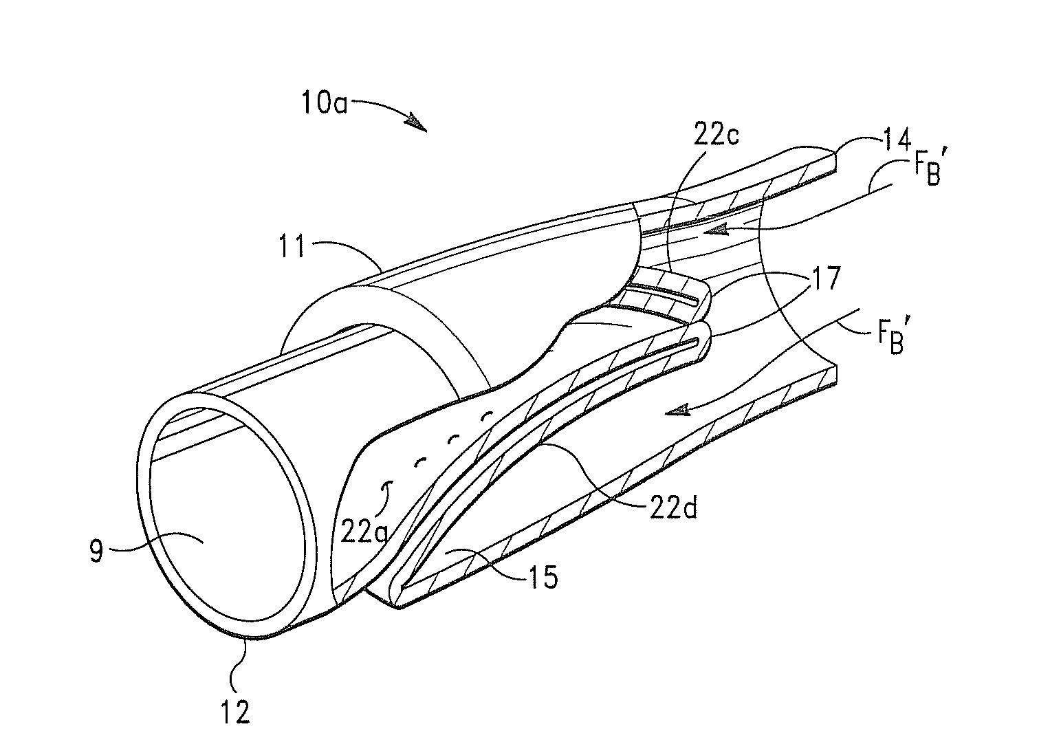 Seamless Tubular Extracellular Matrix Prosthetic Valve and Method for Forming Same