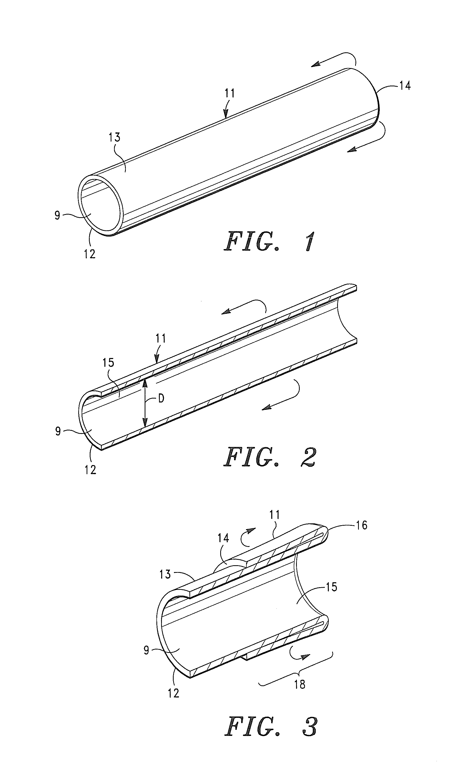 Seamless Tubular Extracellular Matrix Prosthetic Valve and Method for Forming Same