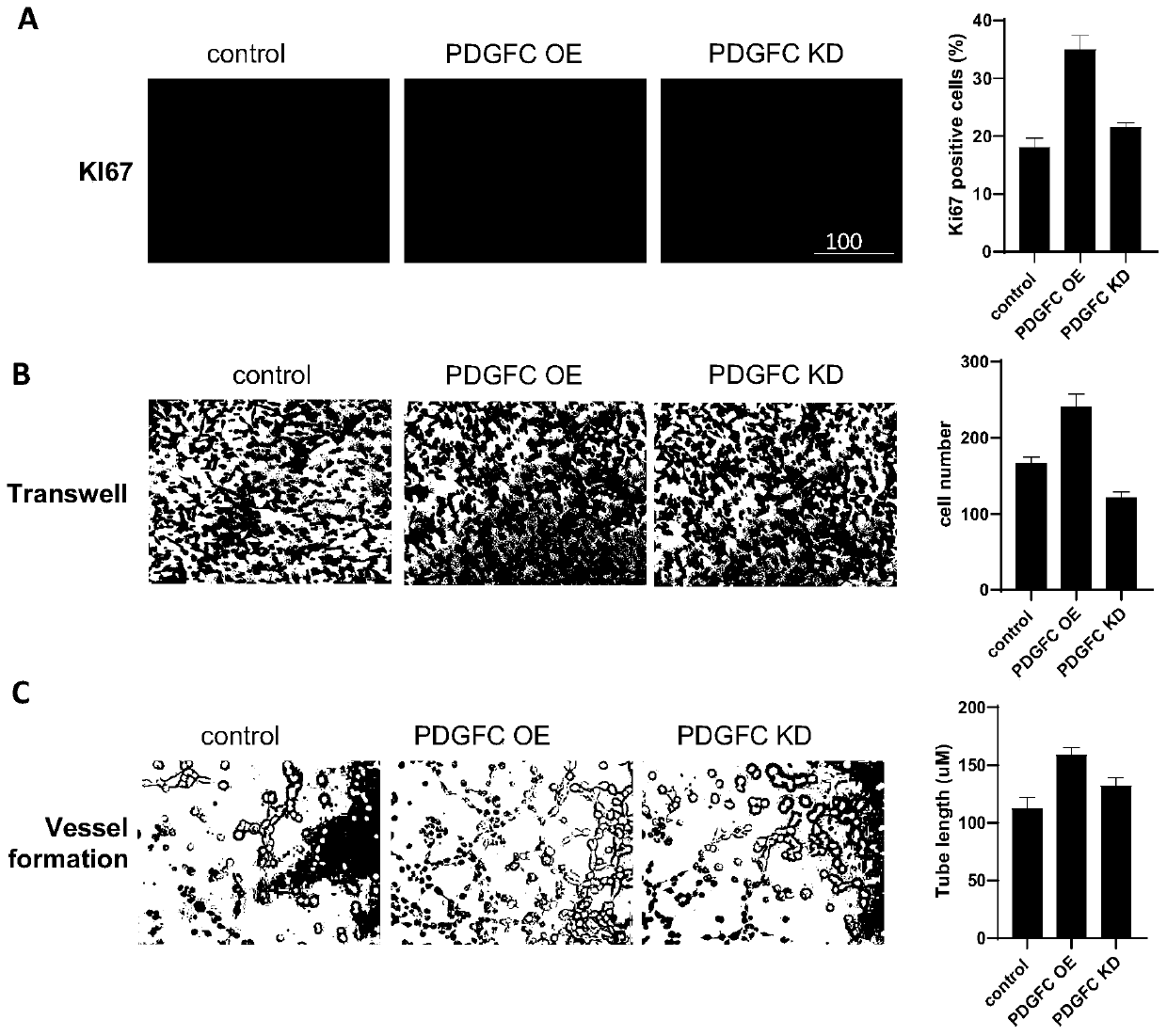 Application of pro-angiogenic factor PDGFC as marker for diagnosis and treatment of hepatopulmonary syndrome