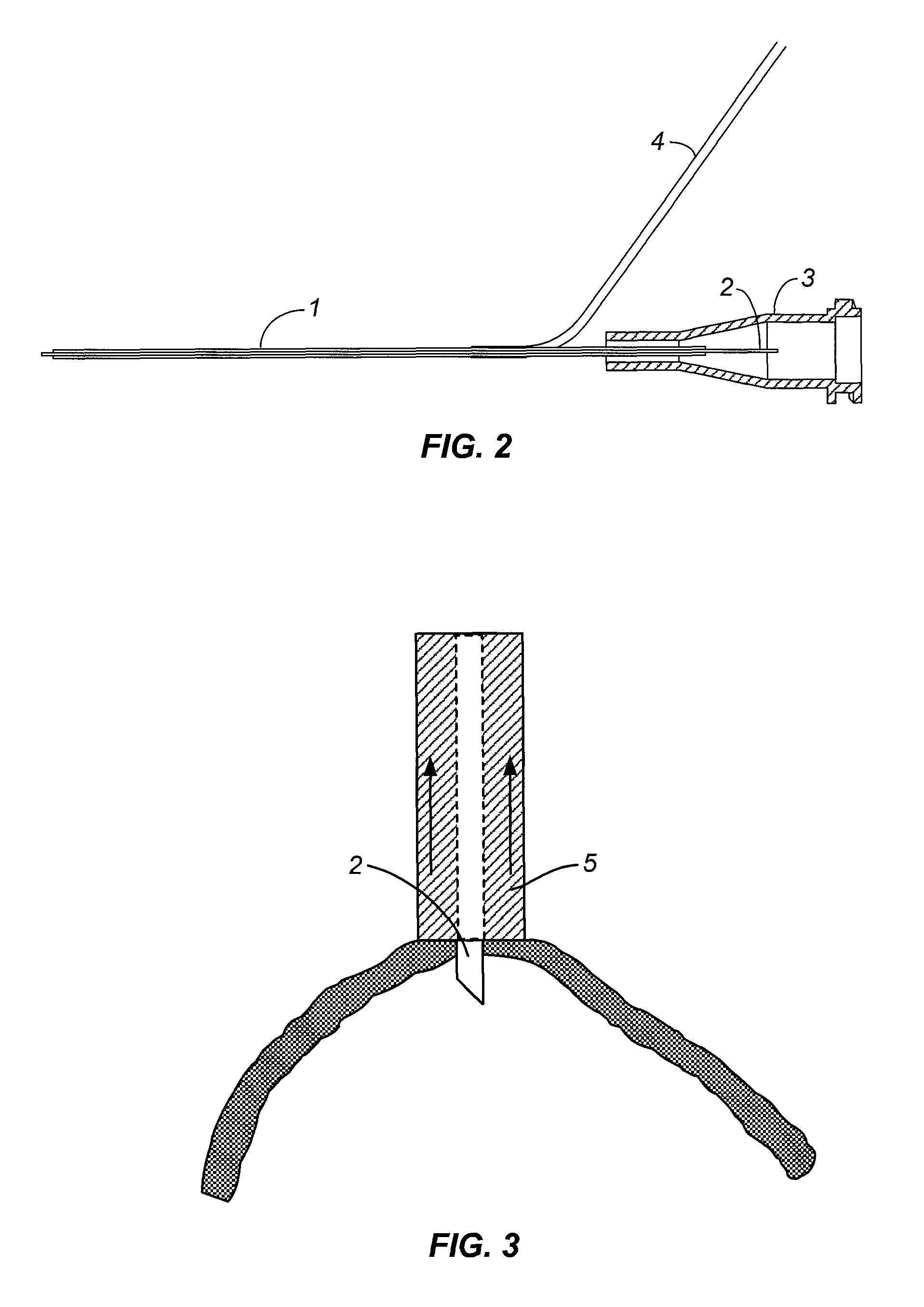 Subretinal access device