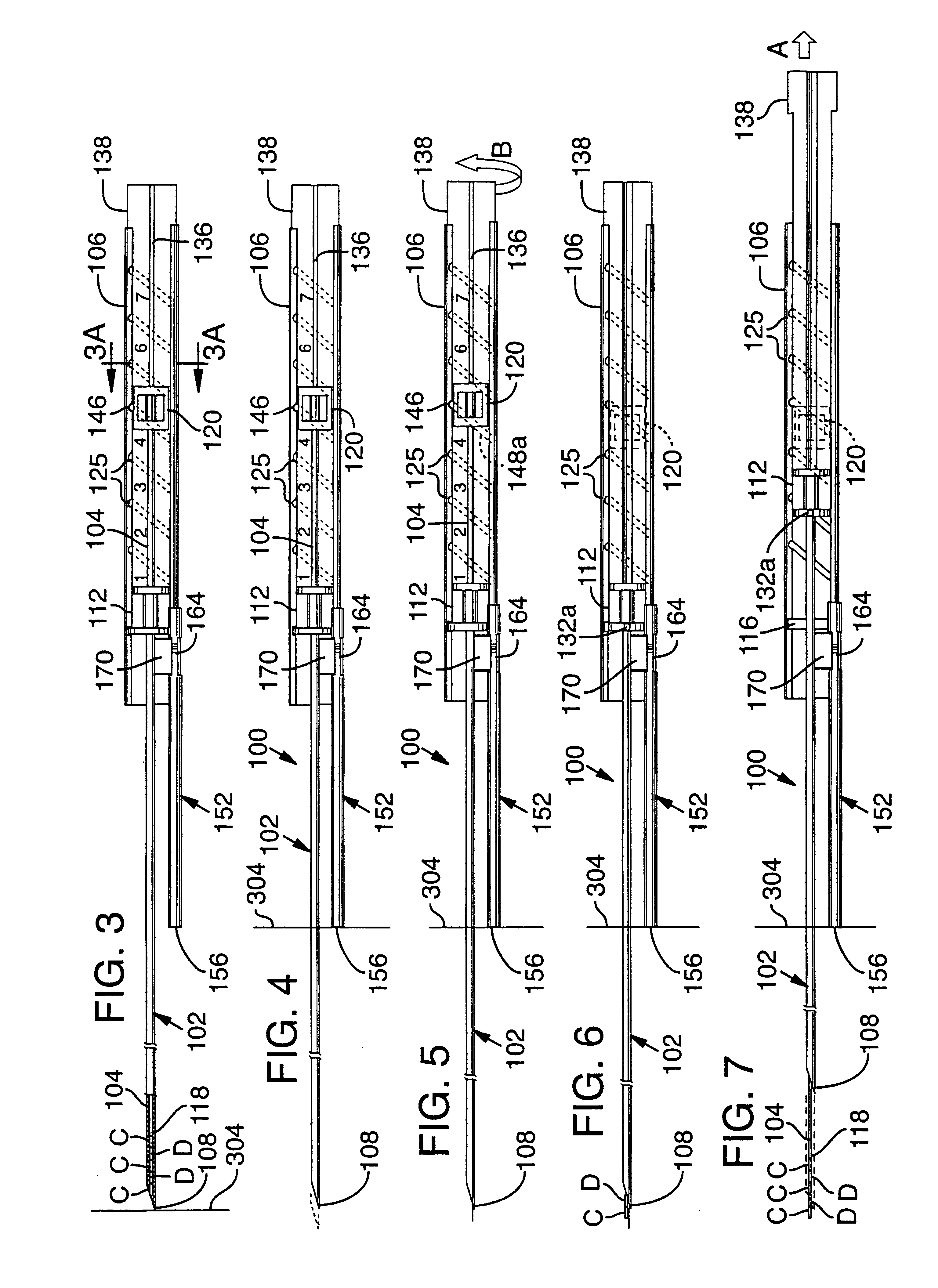 Brachytherapy instrument and methods