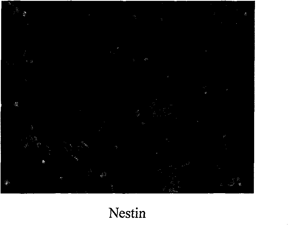 Method for preparing hepatic stem cell decorated by insulin gene and application and preparation thereof