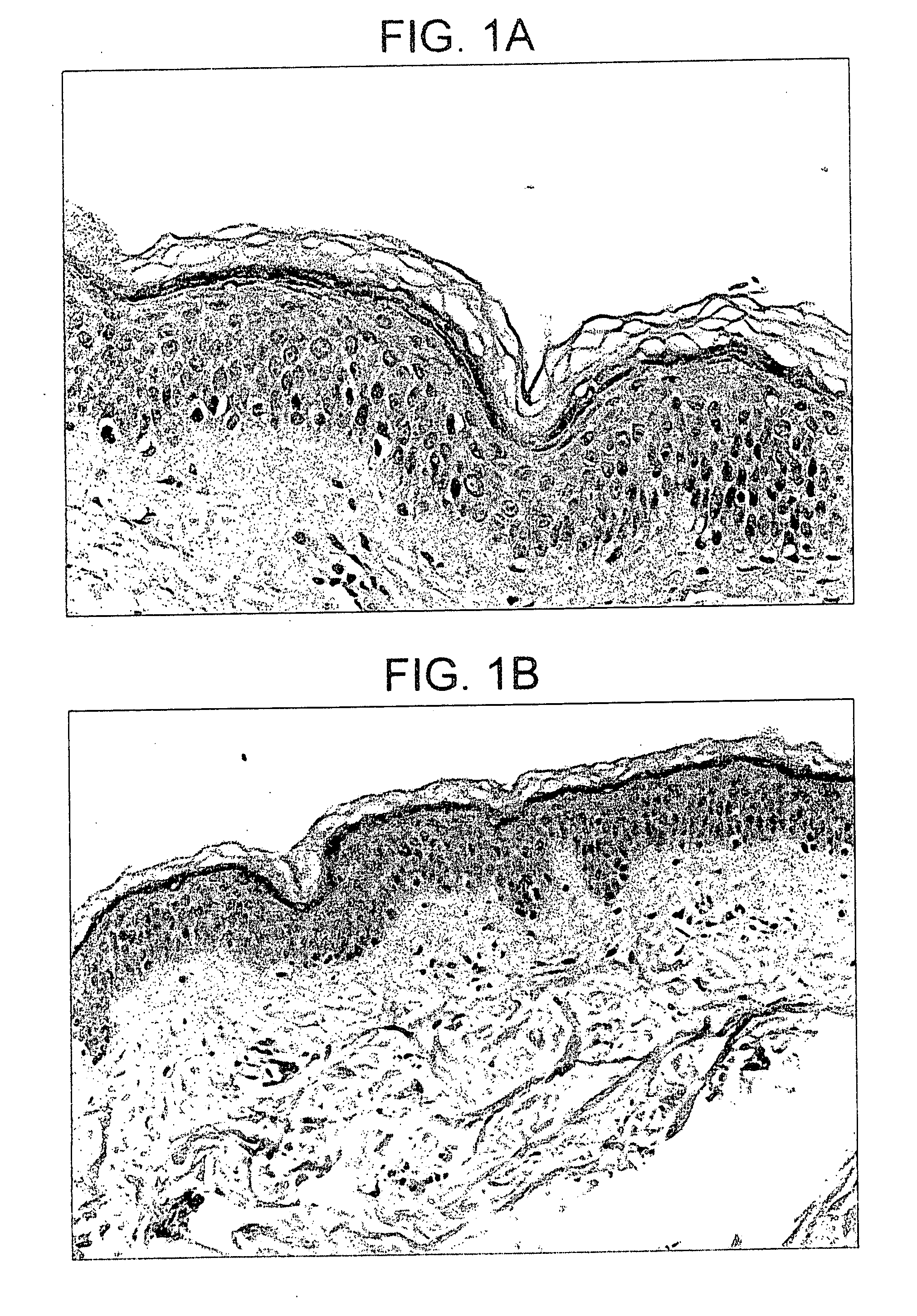 Use of penetration enhancers and barrier disruption methods to enhance the immune response of an antigen