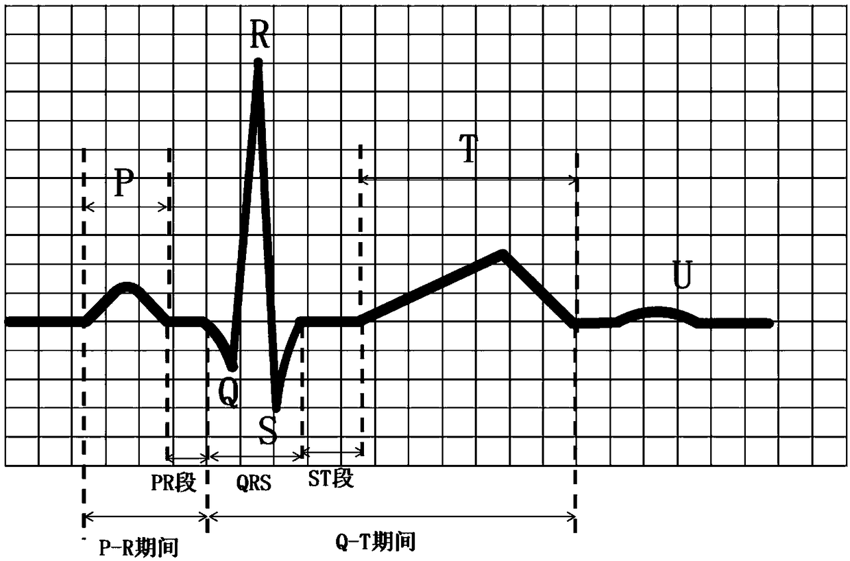 Method, apparatus and system for identifying atrioventricular junctional premature beats in electrocardiogram images