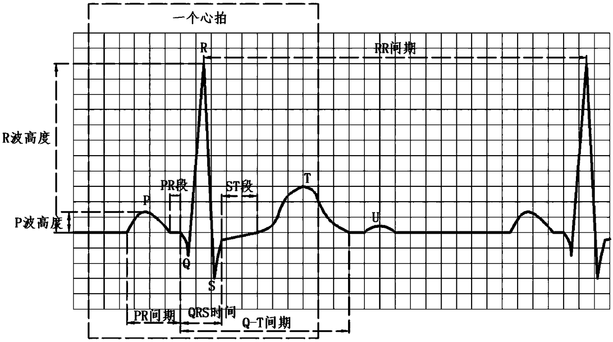 Method, apparatus and system for identifying atrioventricular junctional premature beats in electrocardiogram images