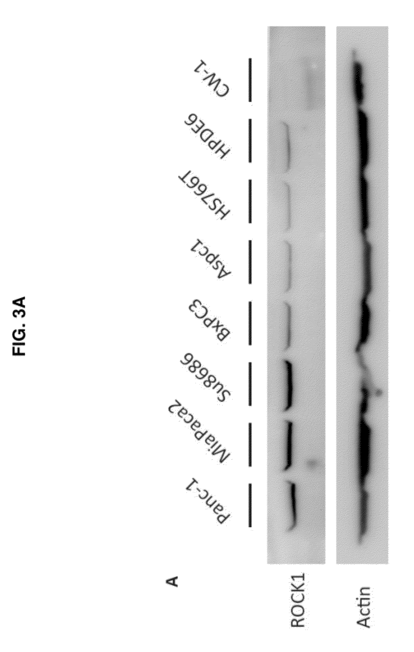 Therapeutic target for pancreatic cancer cells