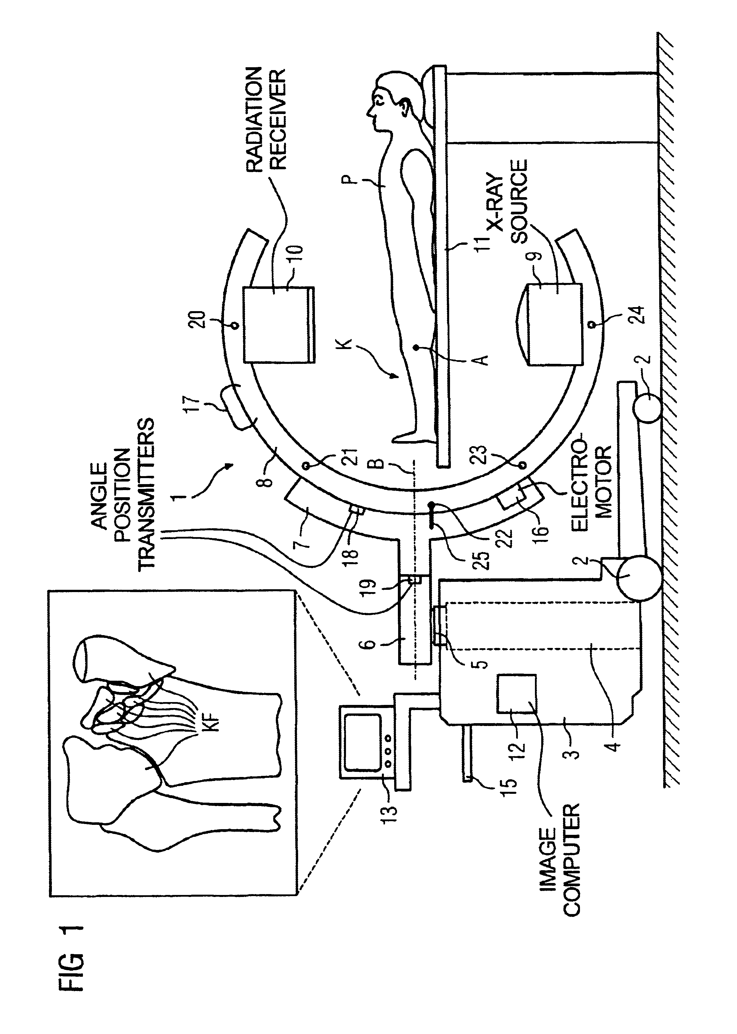 Method for intraoperative generation of an updated volume data set