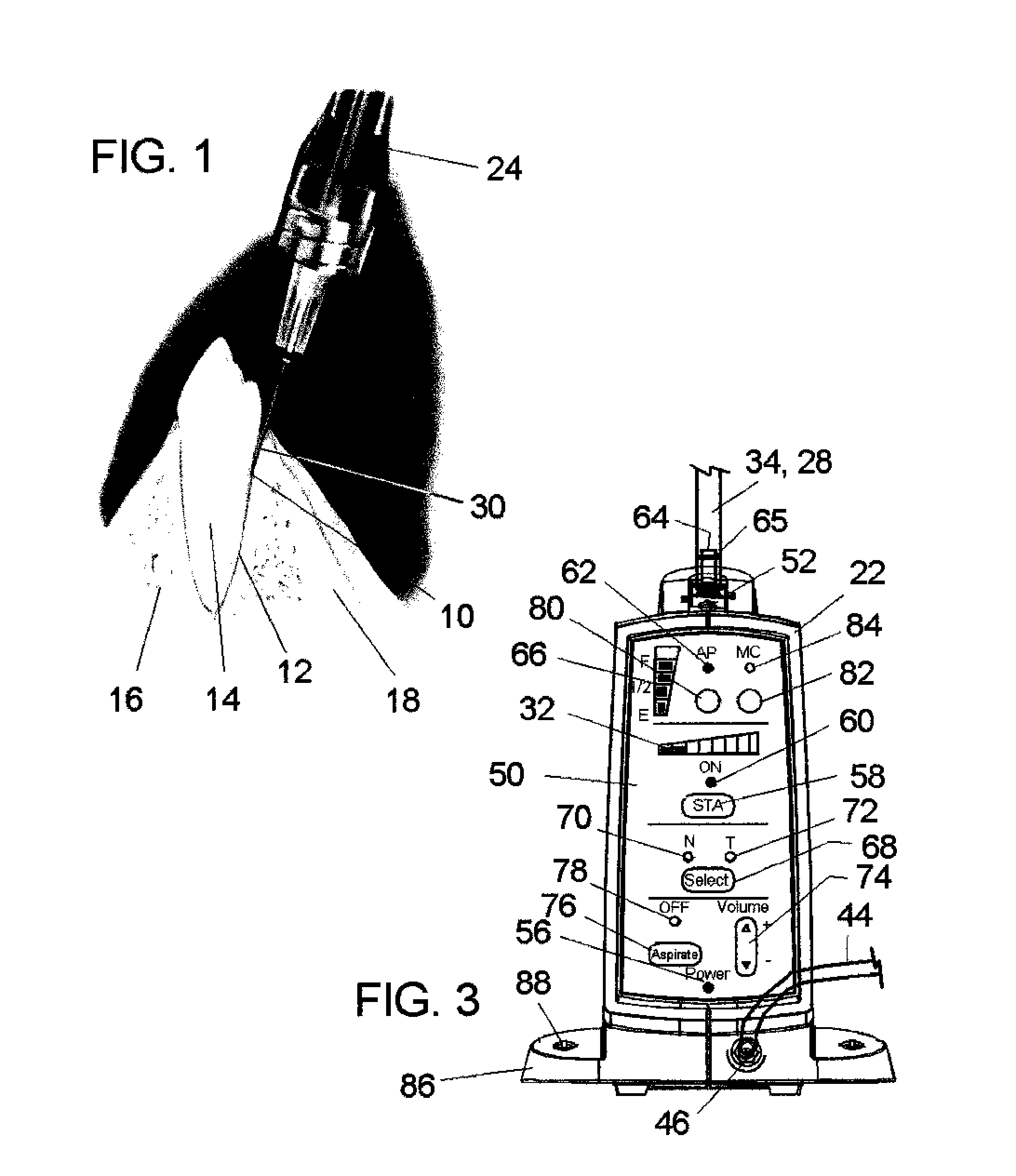 Computer controlled drug delivery system with dynamic pressure sensing