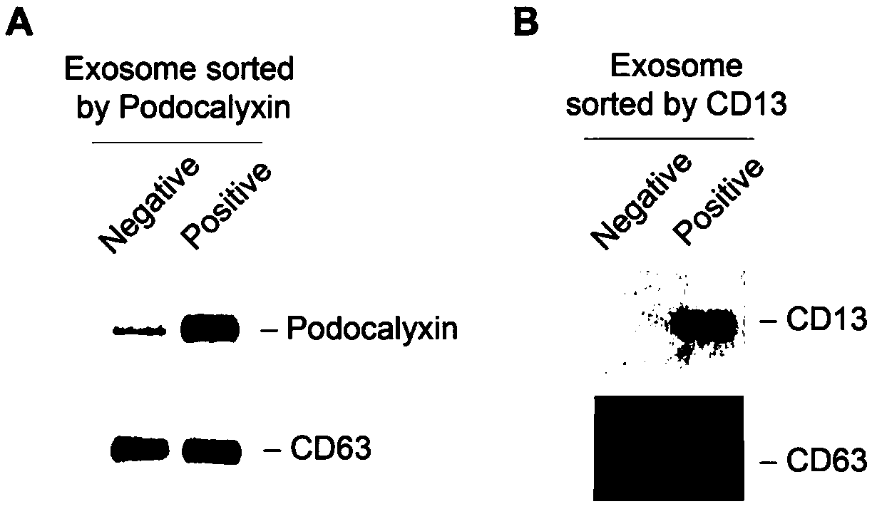 Detection method of protein marker for urine exosome
