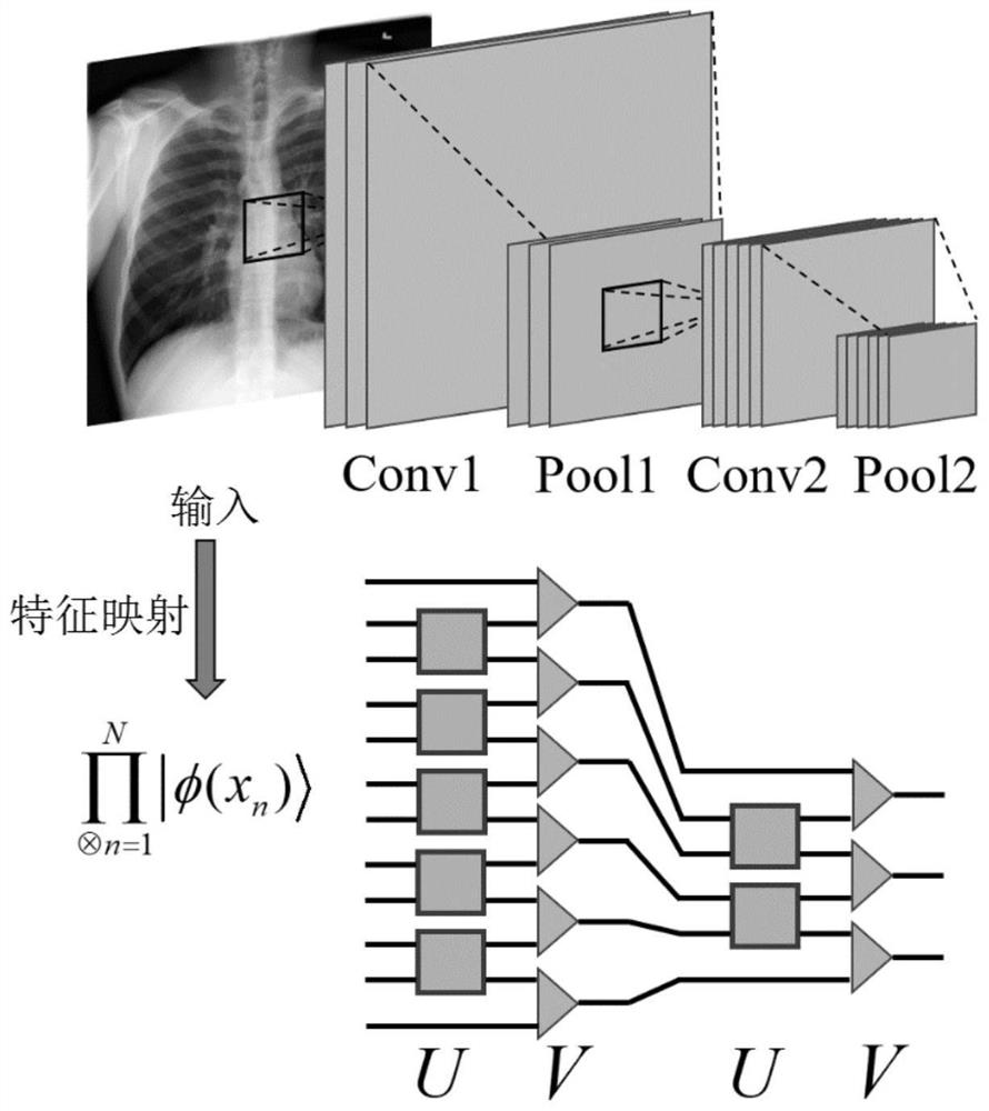 Medical image classification method combining wavelet transform and tensor network