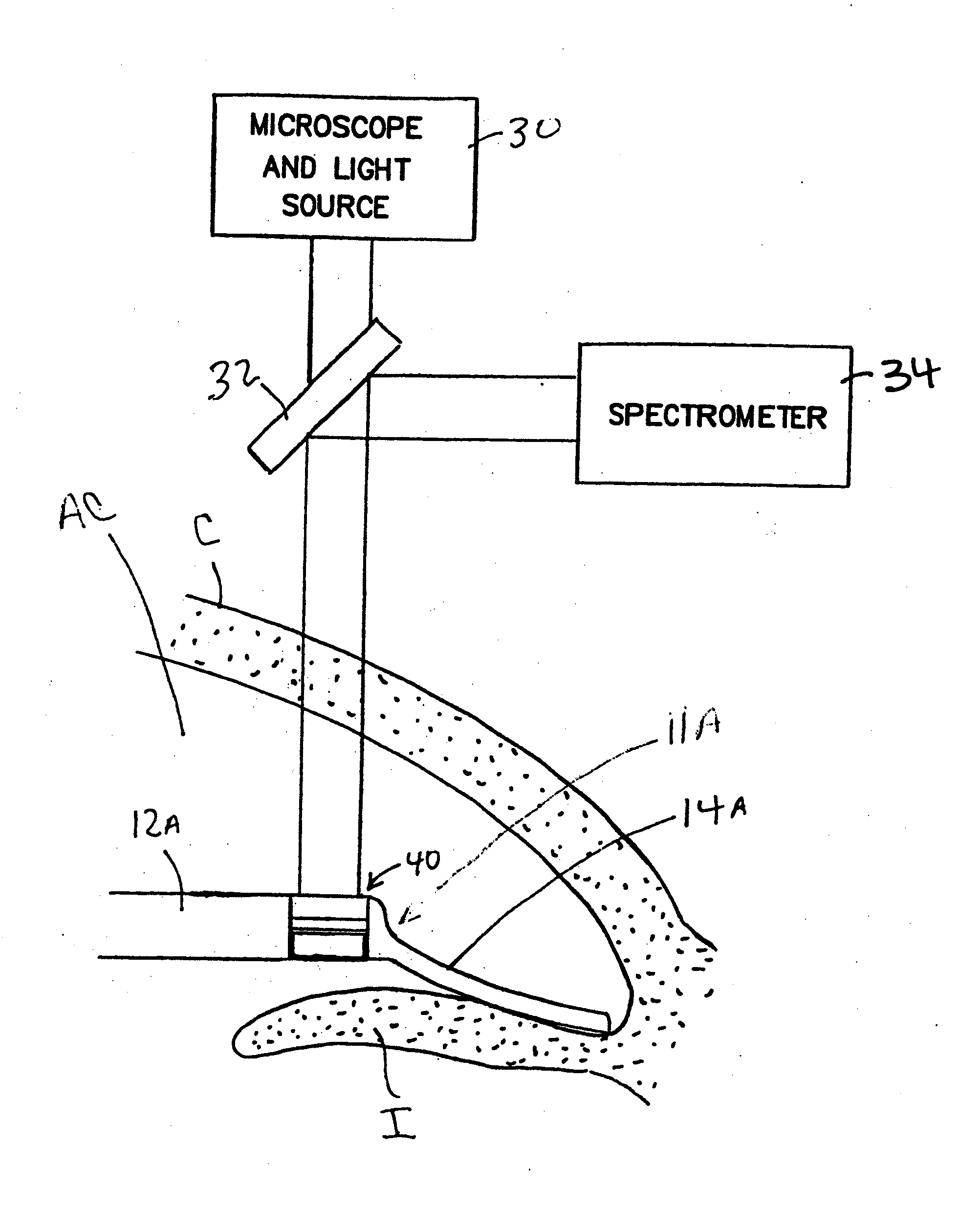 Implantable Devices and Methods for Measuring Intraocular, Subconjunctival or Subdermal Pressure and/or Analyte Concentration
