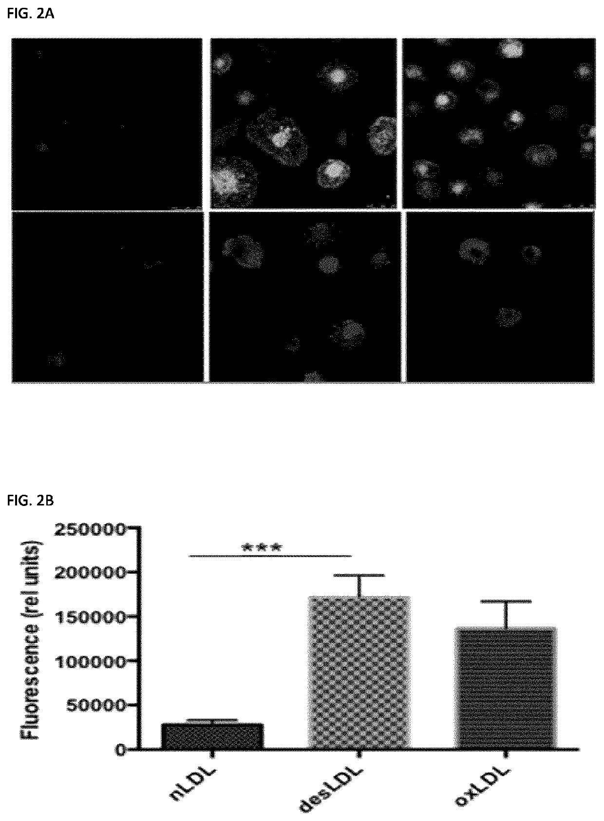 Methods of preventing or treating atherosclerosis with inhibitors of specific isoenzymes of human neuraminidase