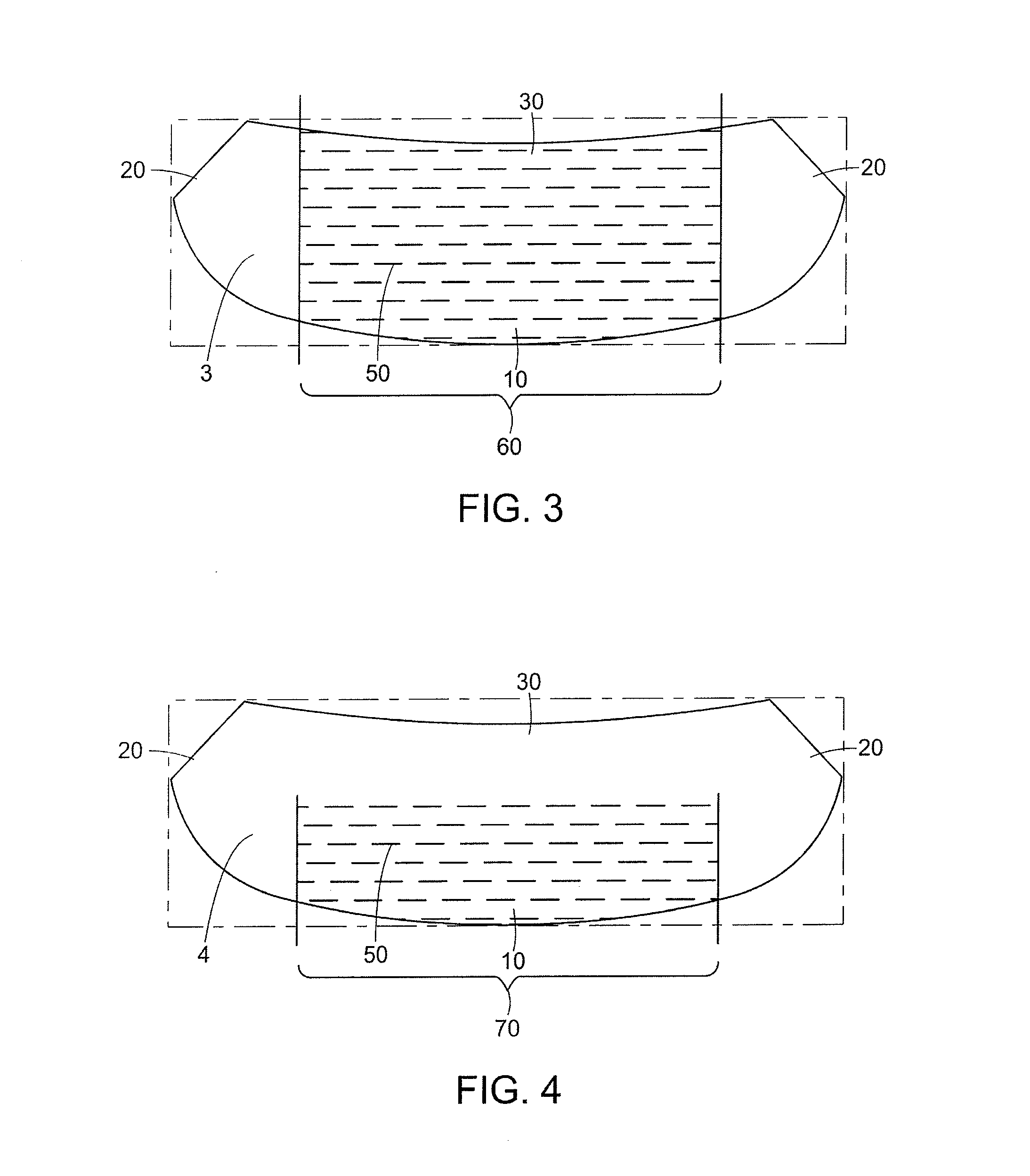 Mastopexy and Breast Reconstruction Prostheses and Method