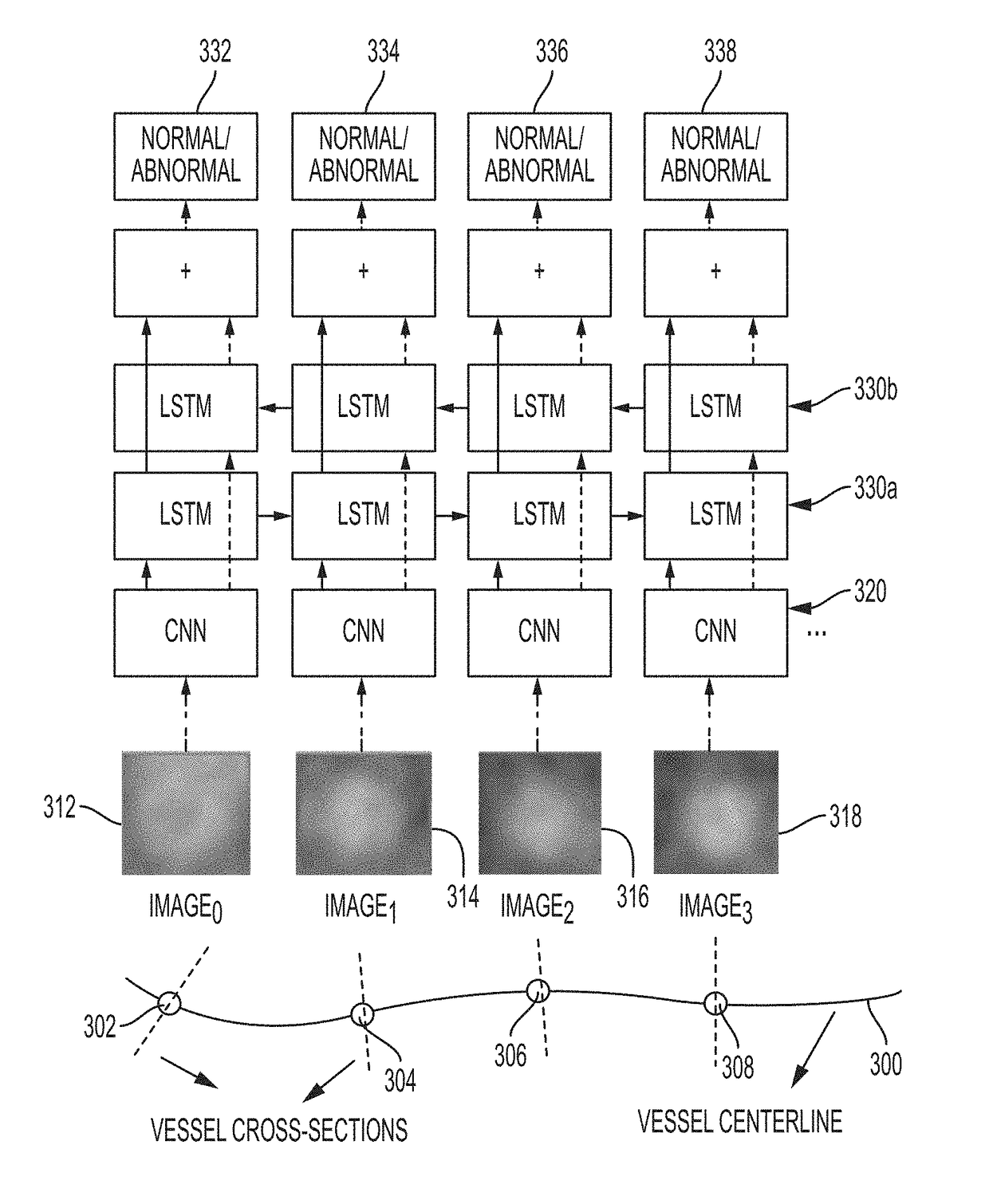 Method and system for vascular disease detection using recurrent neural networks