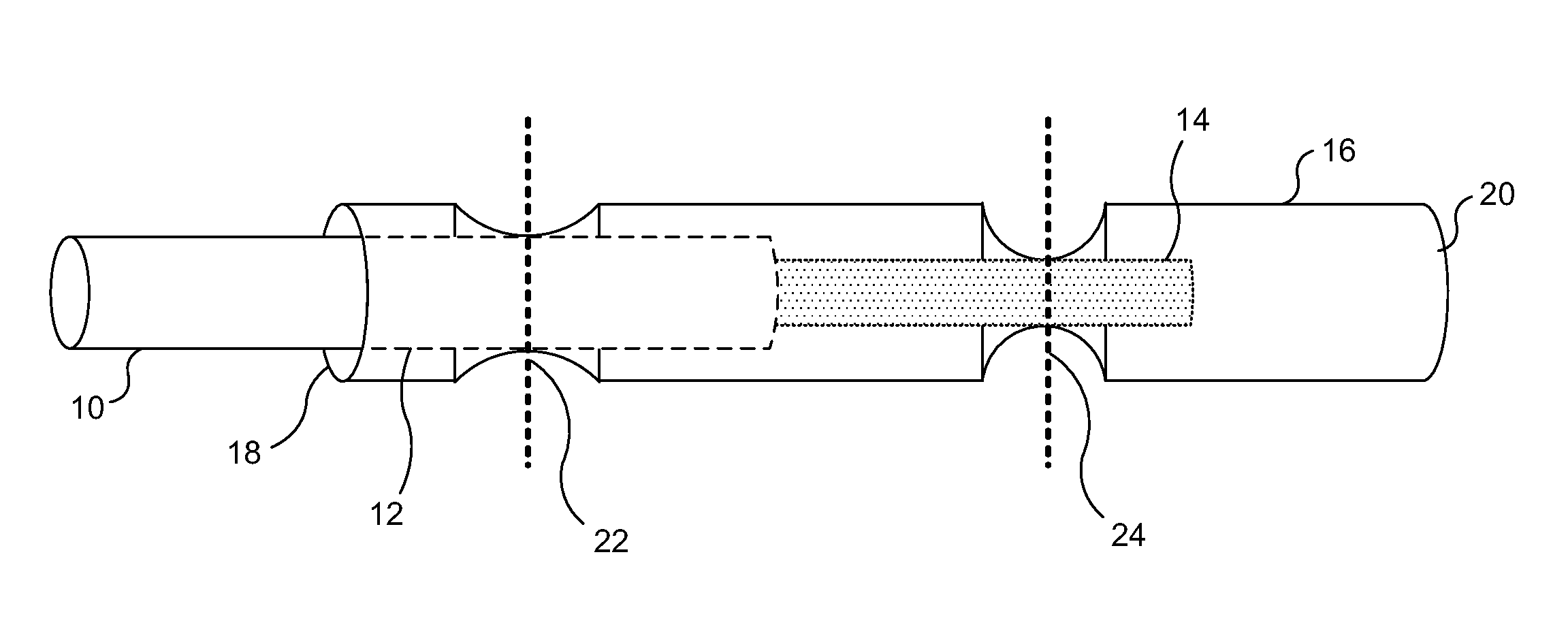 Medical lead termination sleeve for implantable medical devices