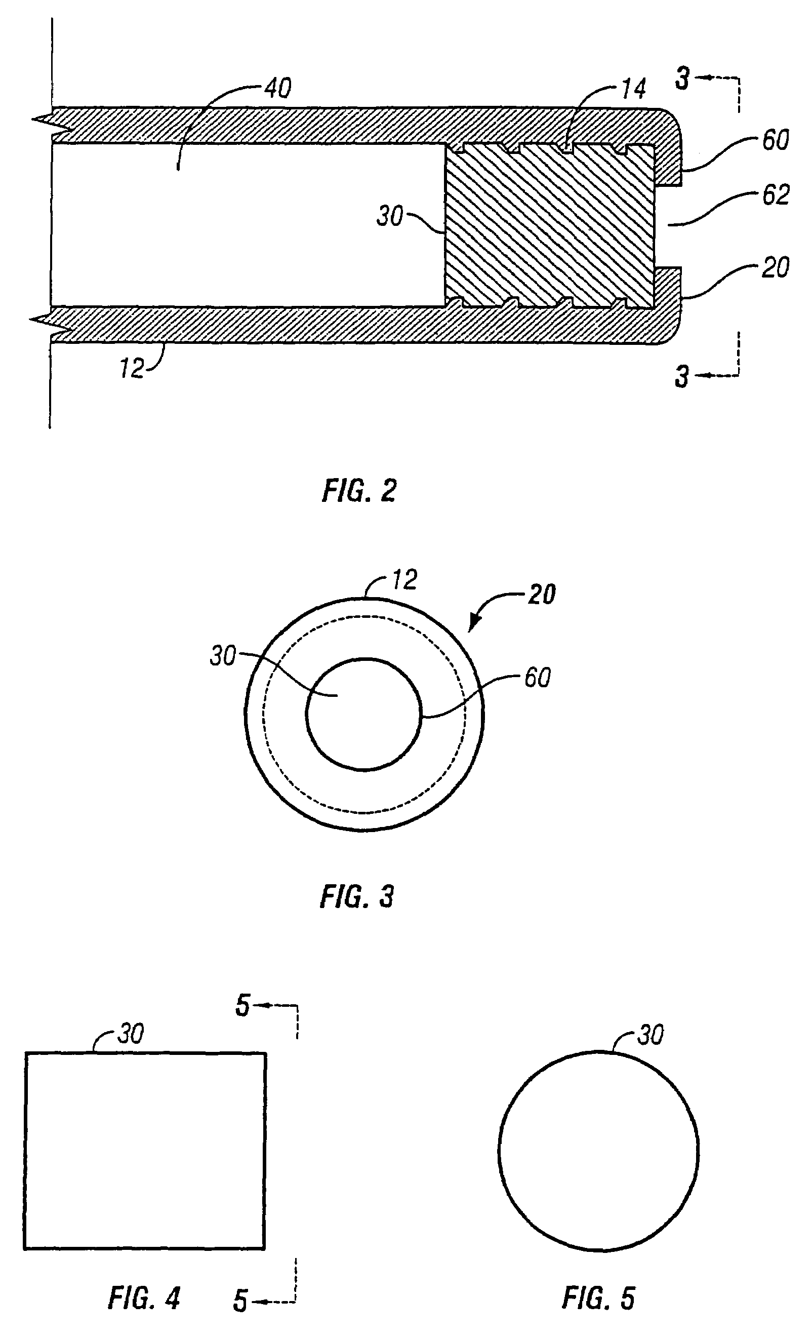 Osmotic implant with membrane and membrane retention means