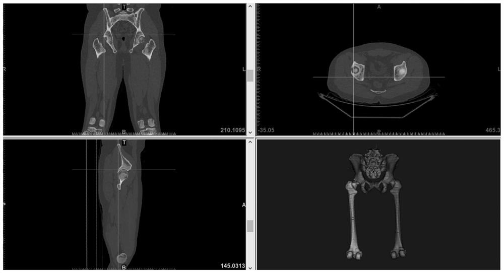 Virtual learning method for total hip replacement surgery